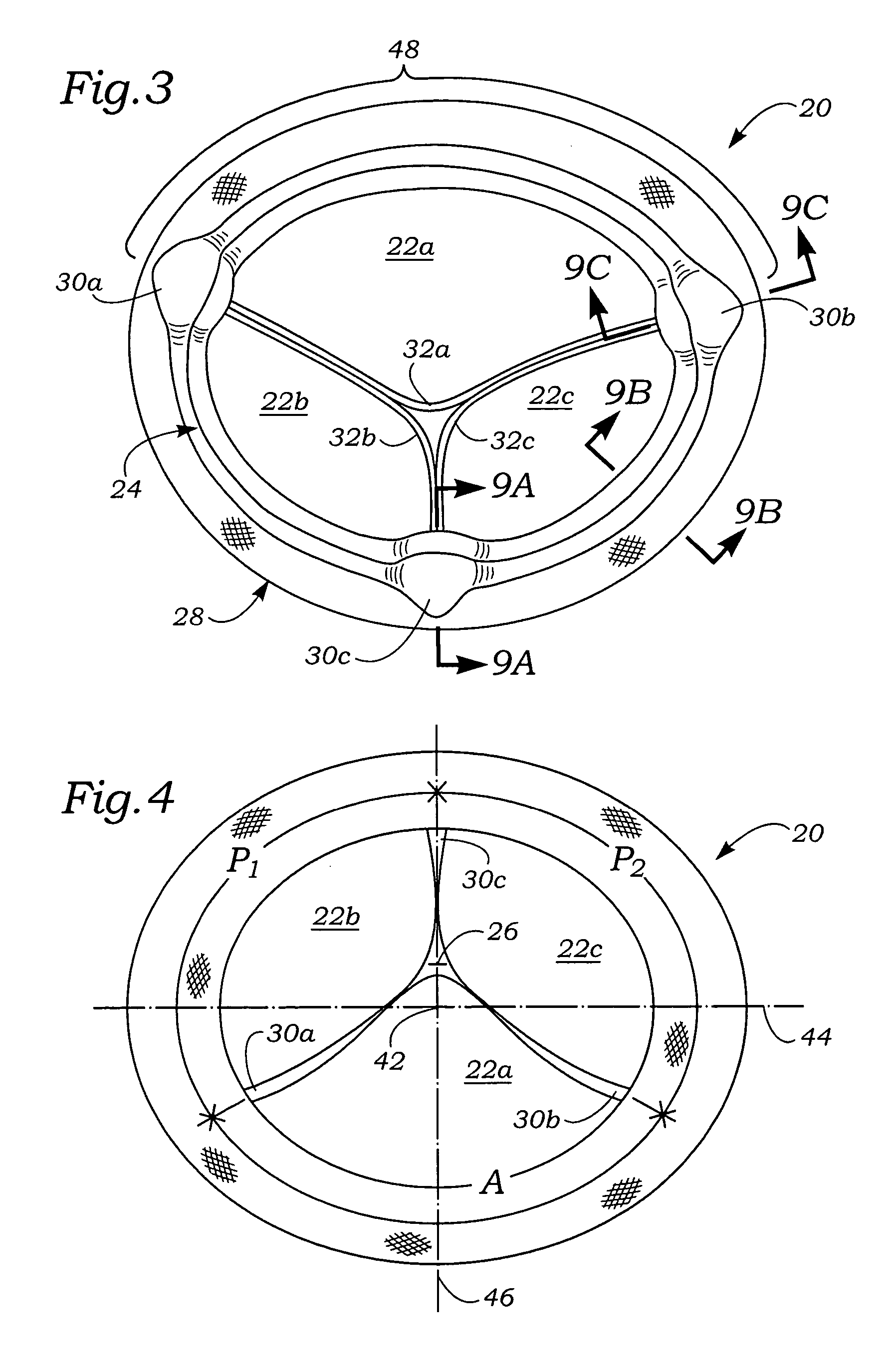 Anatomically approximate prosthetic mitral heart valve