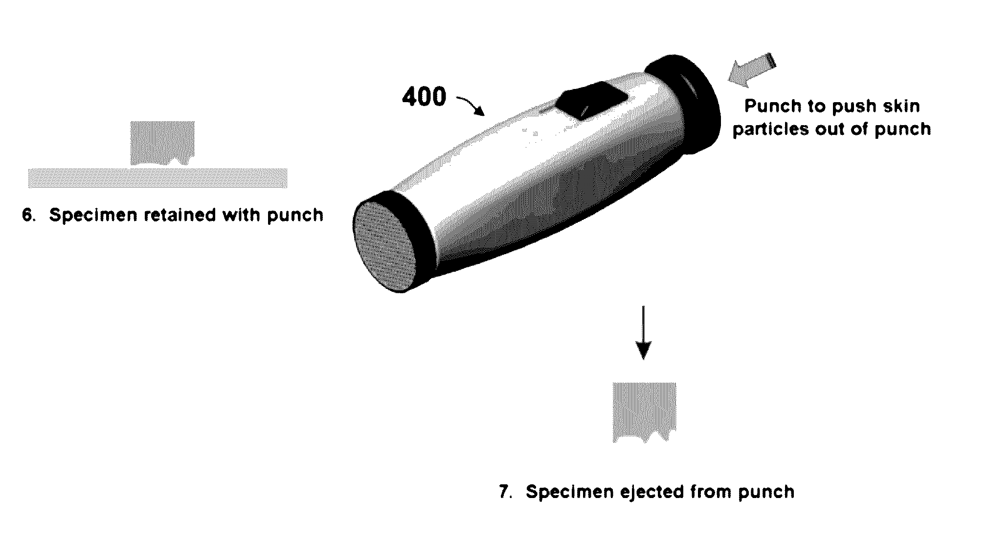 Skin graft devices and methods