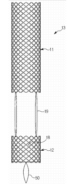 Urethral stent for the prostate