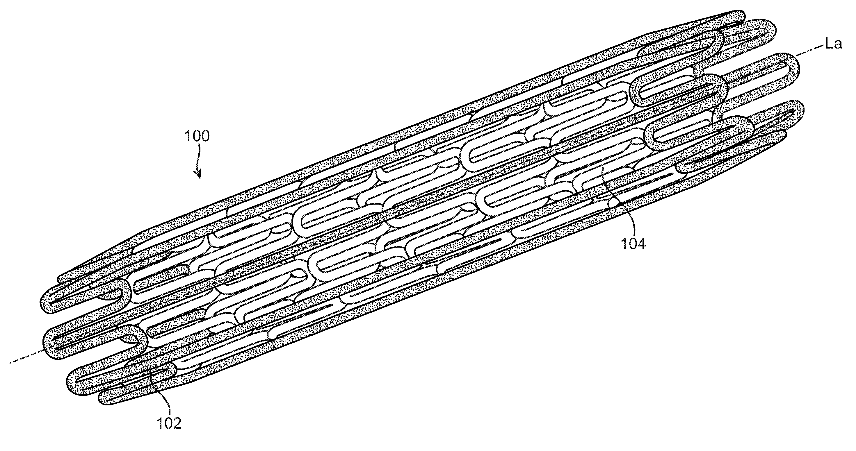 Double-Walled Stent System