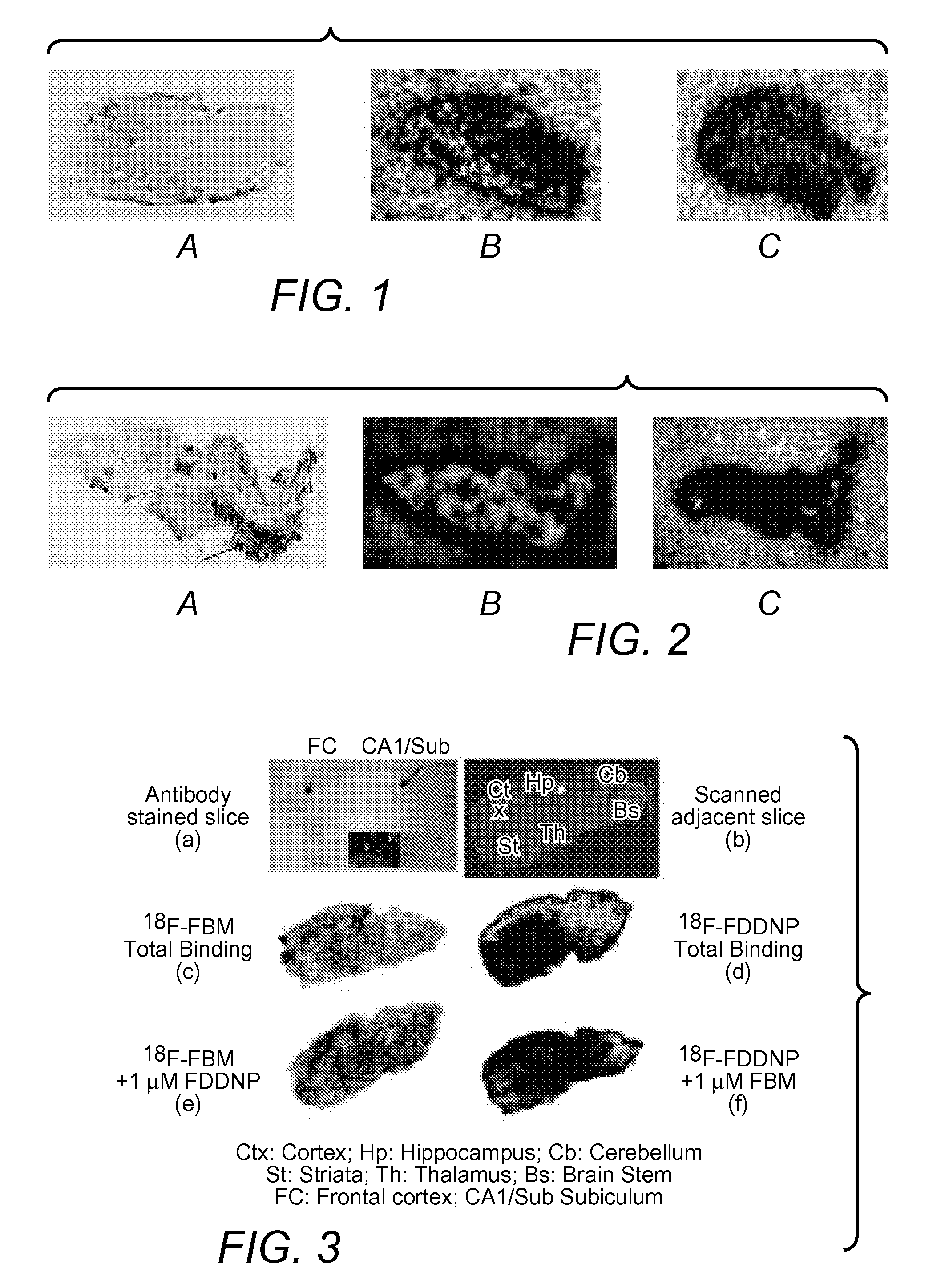 Beta-amyloid and neurofibrillary tangle imaging agents