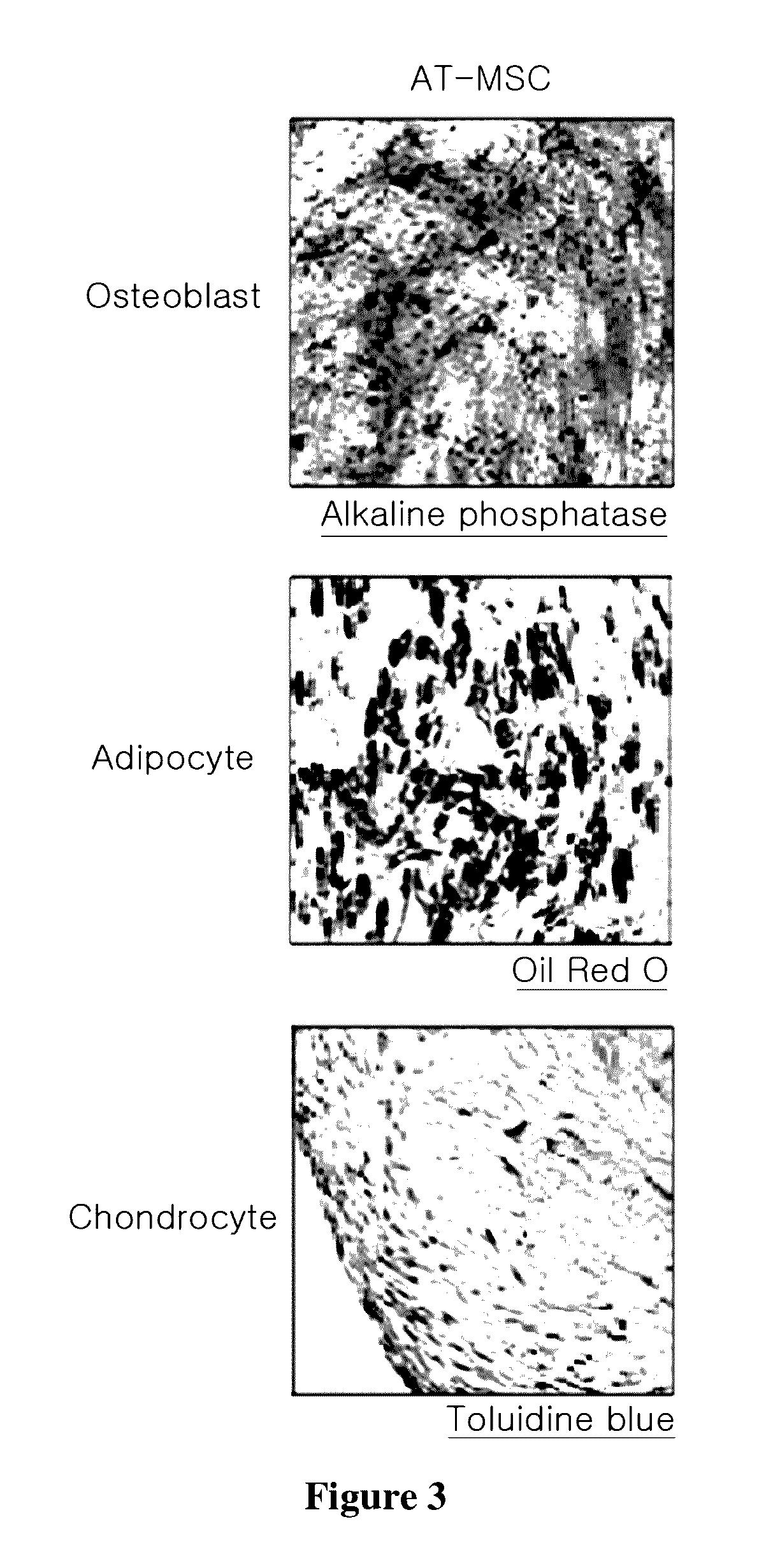 Method for differentiating stem cells into neurons