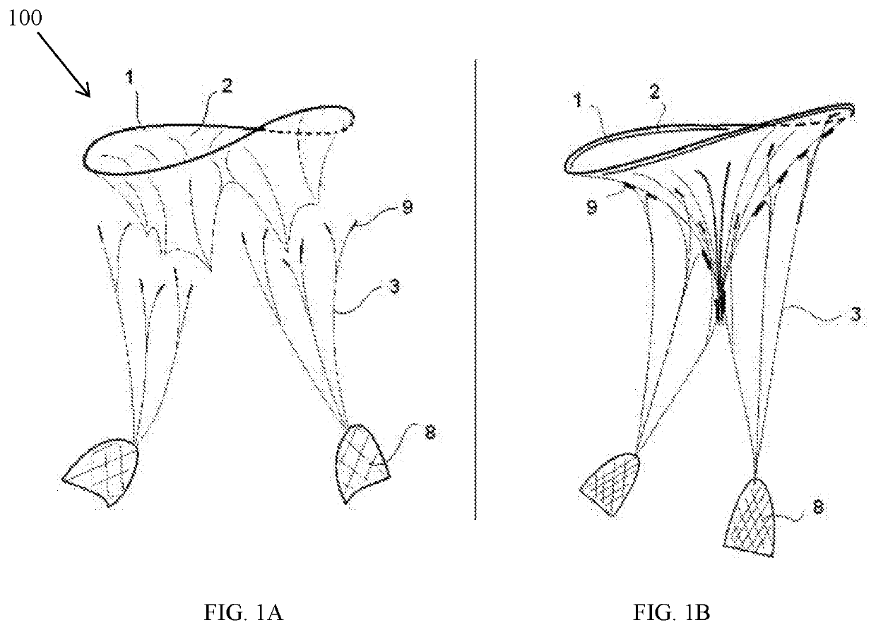 Naturally designed mitral prosthesis