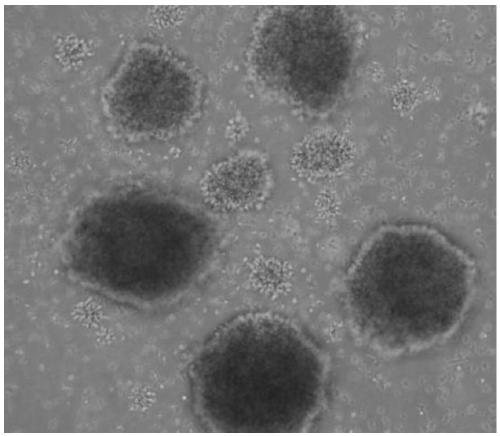 Reagent for inducing peripheral blood mononuclear cells into CIK cells and composition used by reagent