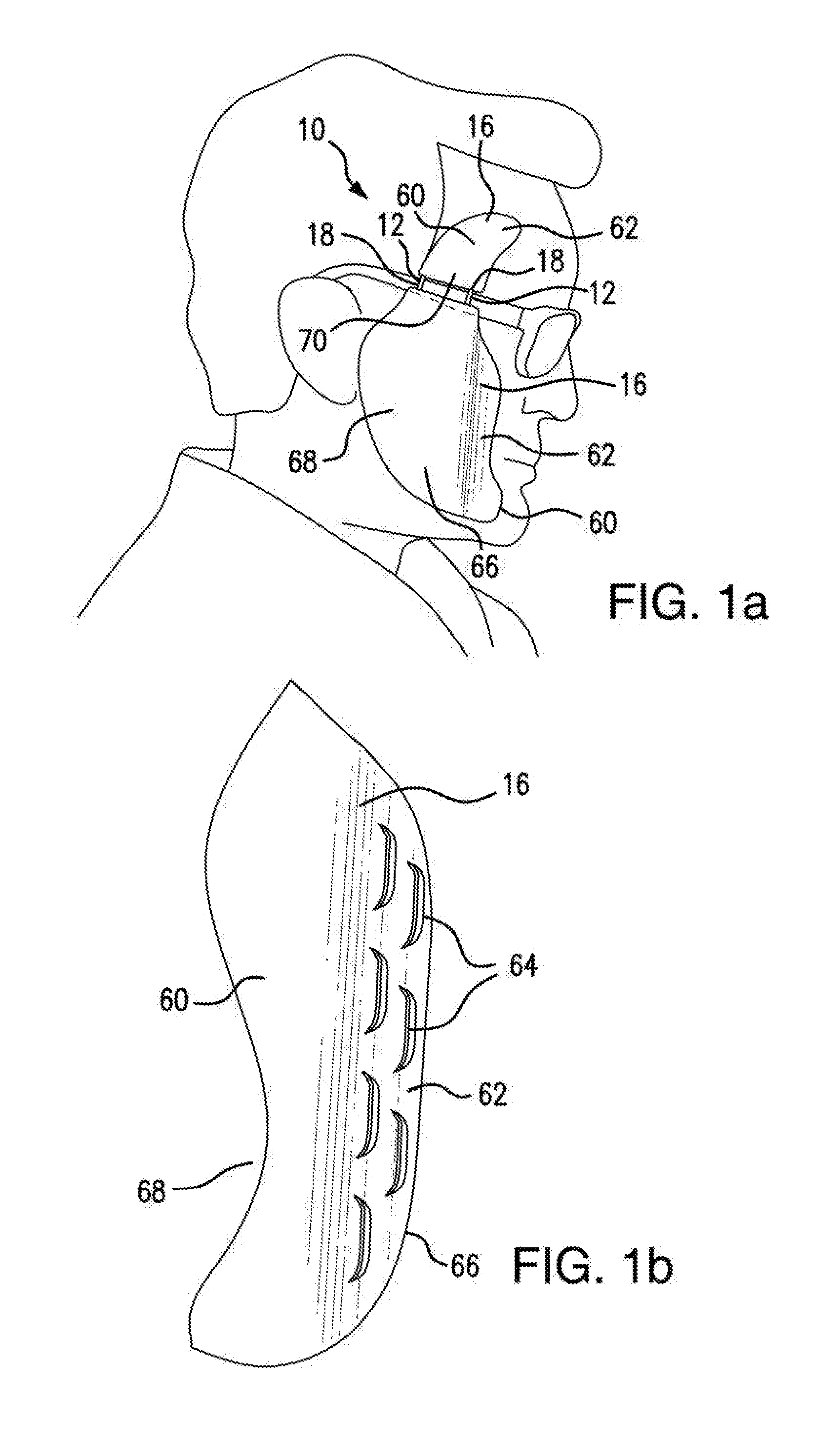 Protective skin shields system