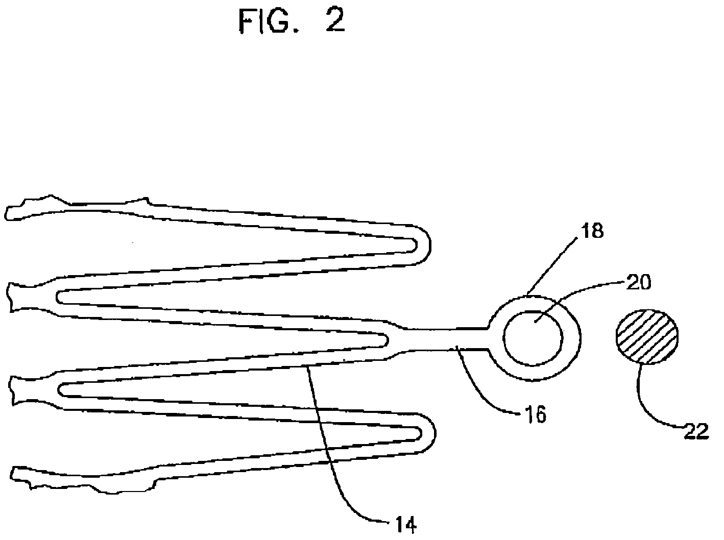 Process method for attaching radio opaque markers to shape memory stent