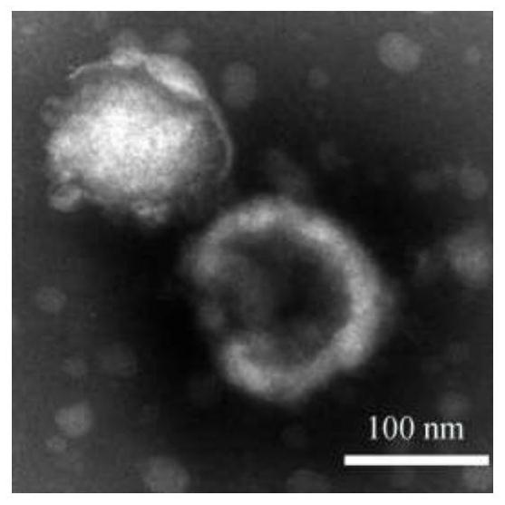 Targeting peptide modified traditional Chinese medicine multi-component exosome-like fusion nanoparticle as well as preparation method and application thereof