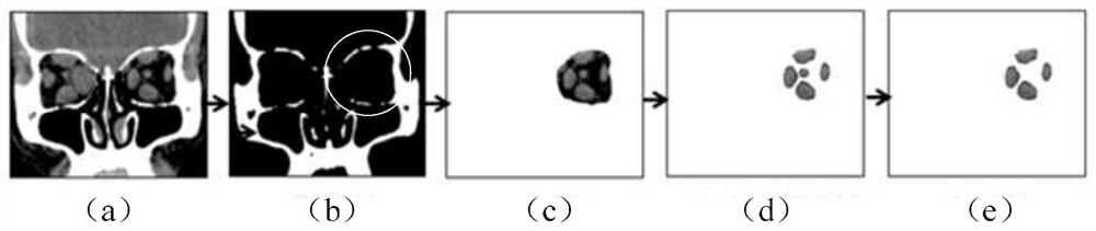 A method and device for measuring eye parameters