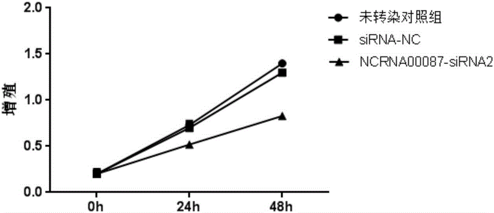 Diagnosis and treatment marker of prostate cancer