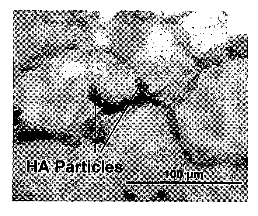 Layered Scaffold Suitable for Osteochondral Repair