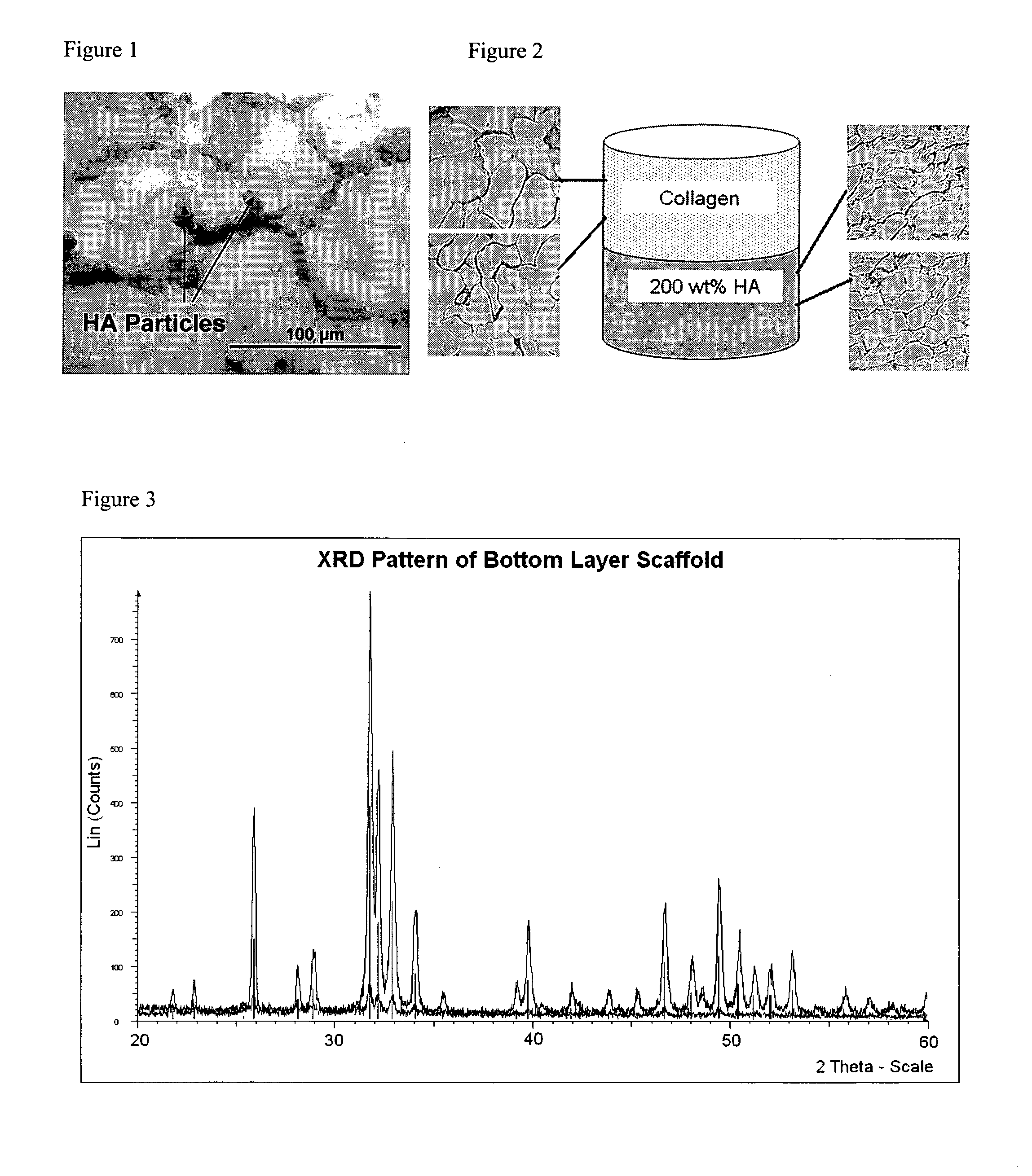 Layered Scaffold Suitable for Osteochondral Repair