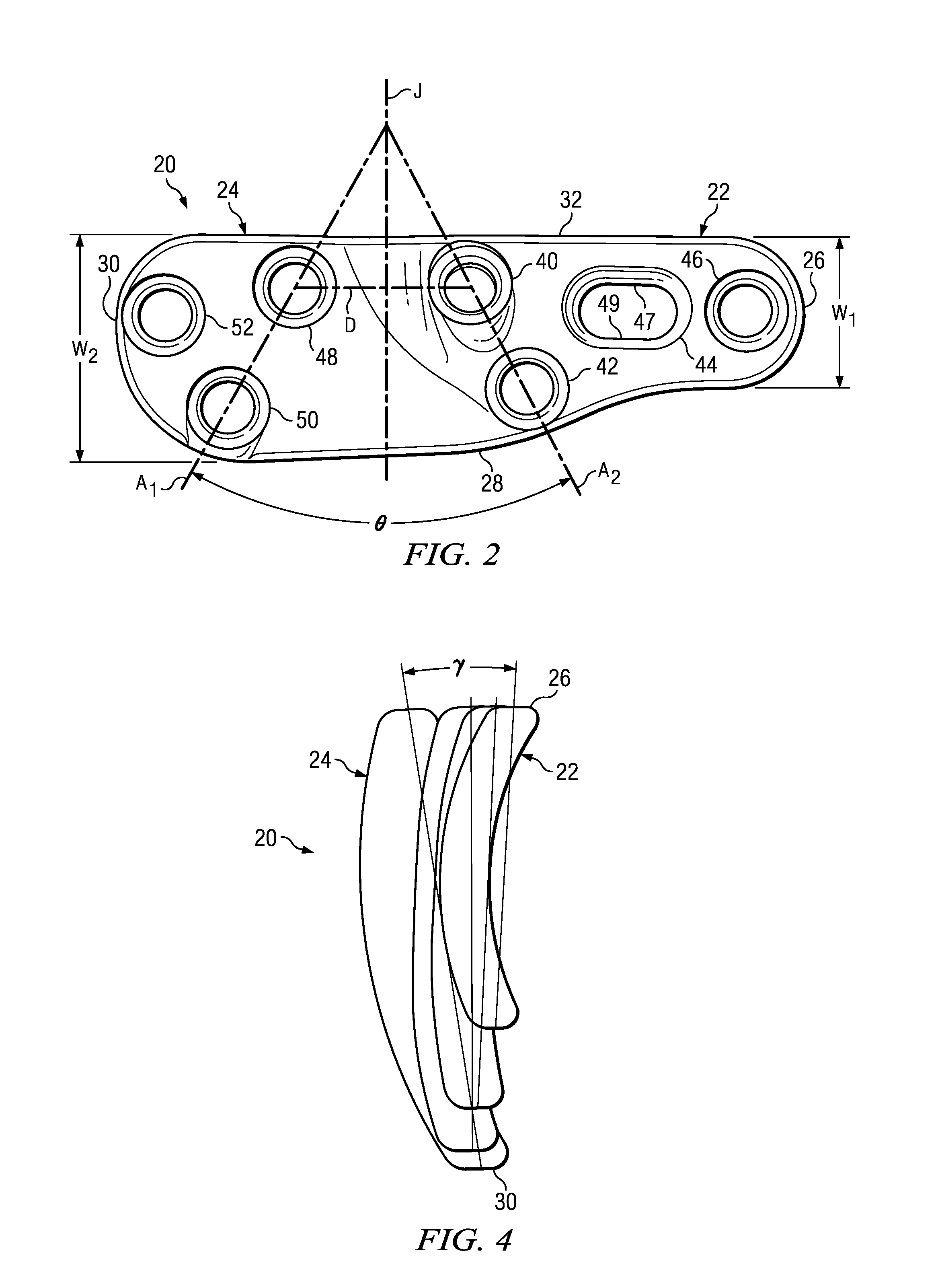 Fixation plate for use in the Lapidus approach