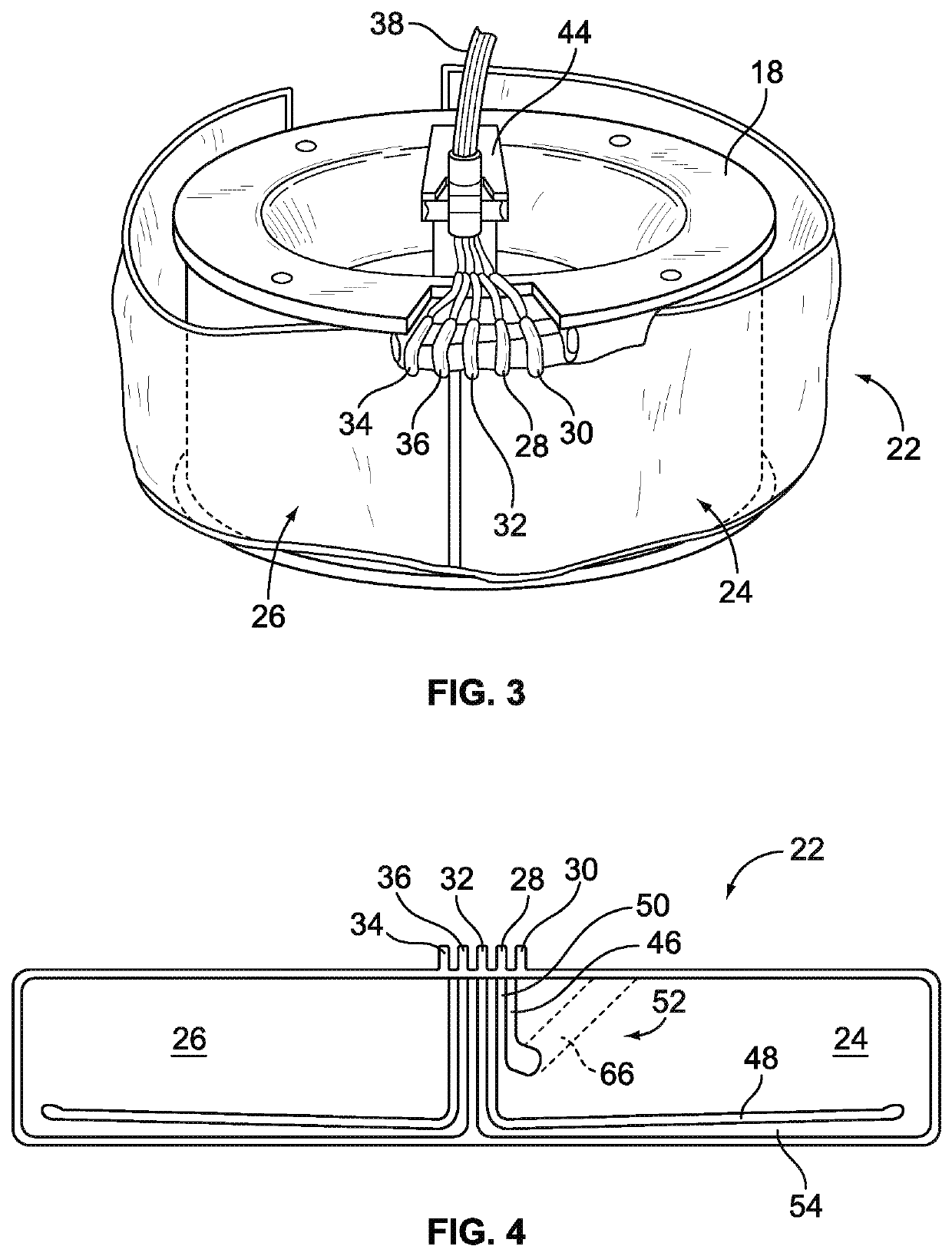 Optical detection and measurement of hematocrit and free hemoglobin concentration