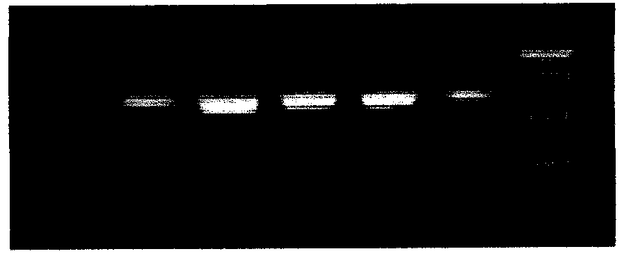 Mycoplasma pneumonia antigen, preparation method and immunodetection kit