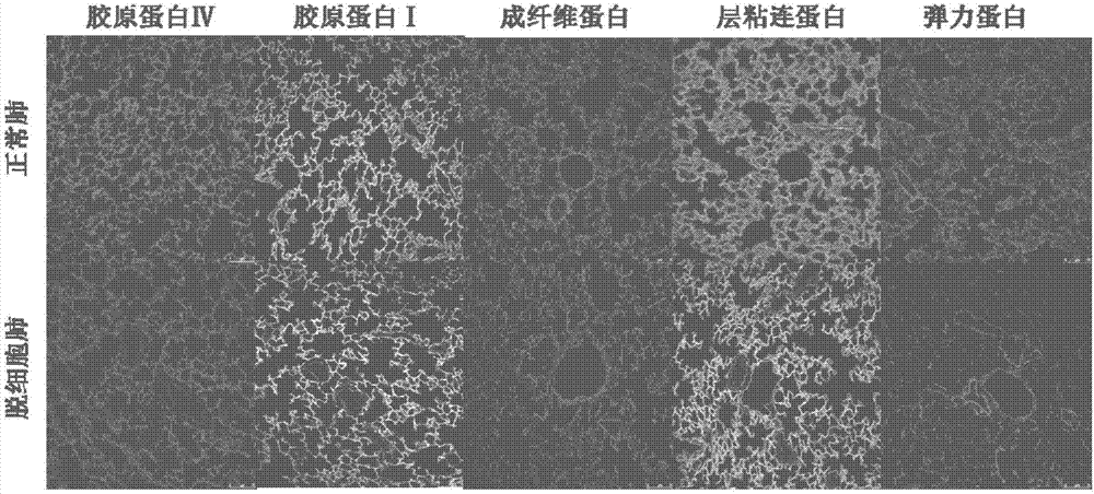 Decellularized pulmonary support and preparation method thereof