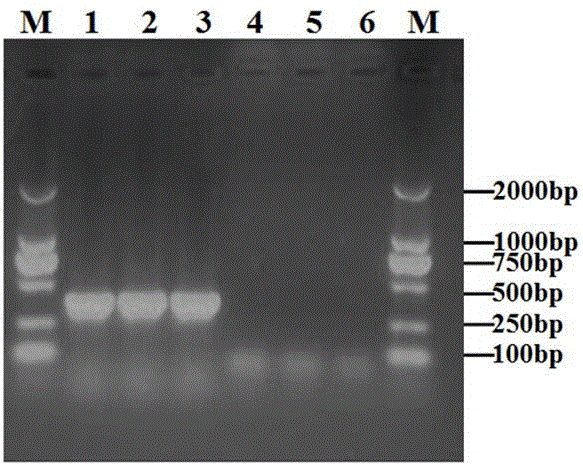 Alternaria solani PCR detection specific primer and detection method thereof