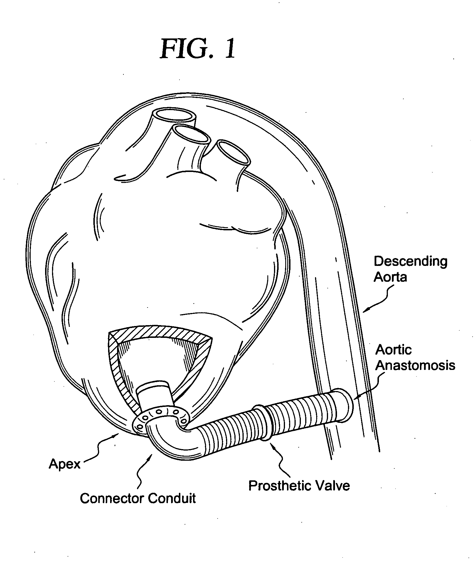 Apparatus and method for connecting a conduit to a hollow vessel