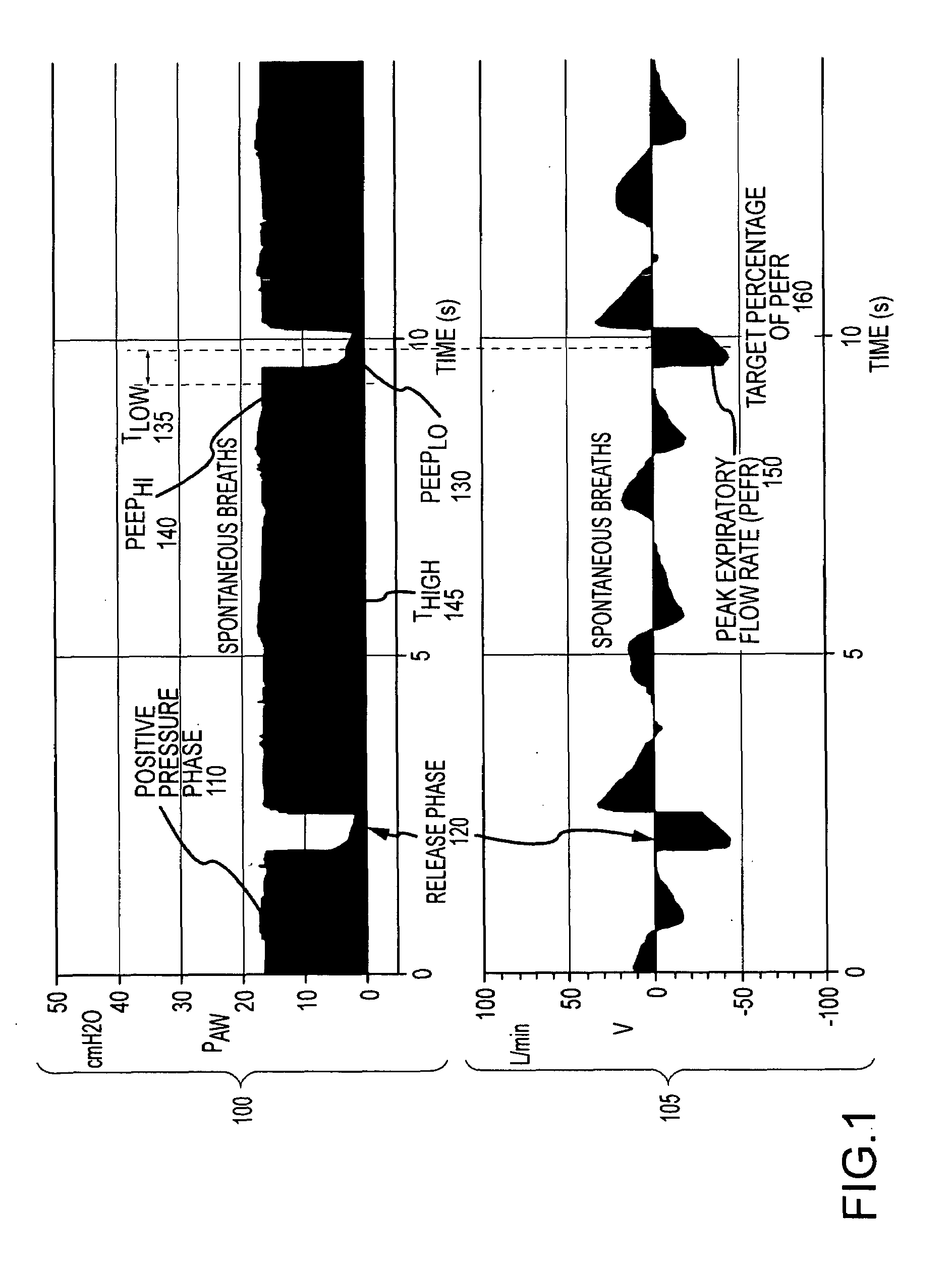 Configuring the operation of an alternating pressure ventilation mode