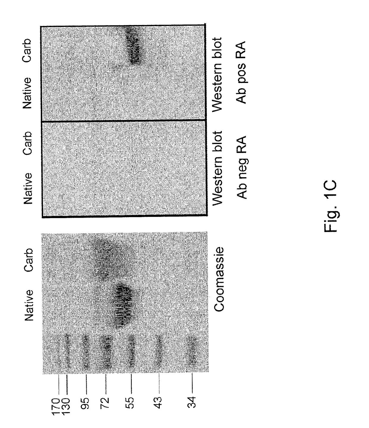 Anti-carbamylated protein antibodies and the risk for arthritis