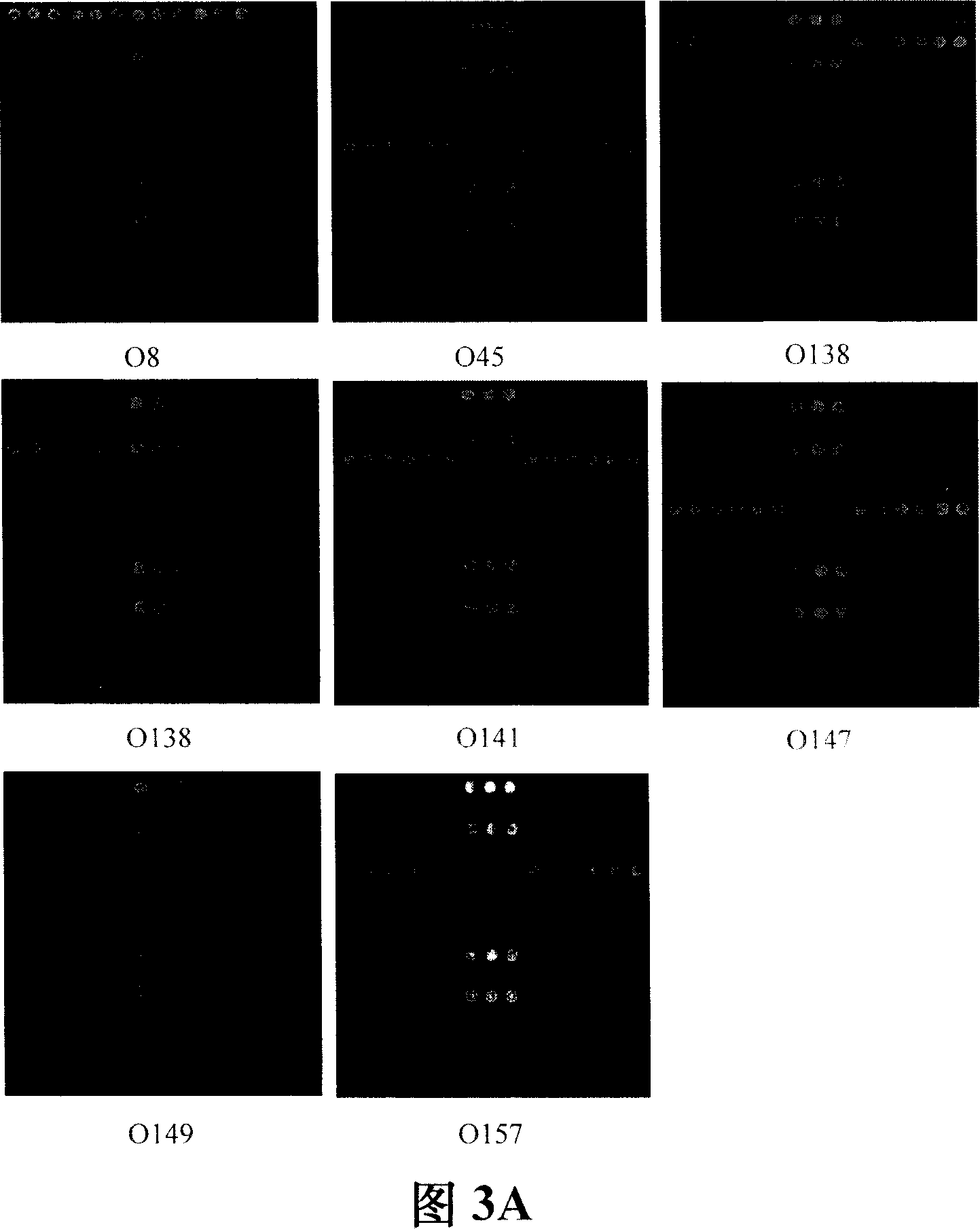 Method for detecting bacillus coli inducing diarrhoea and hydropsy during pig weaning period and reagent kit thereof