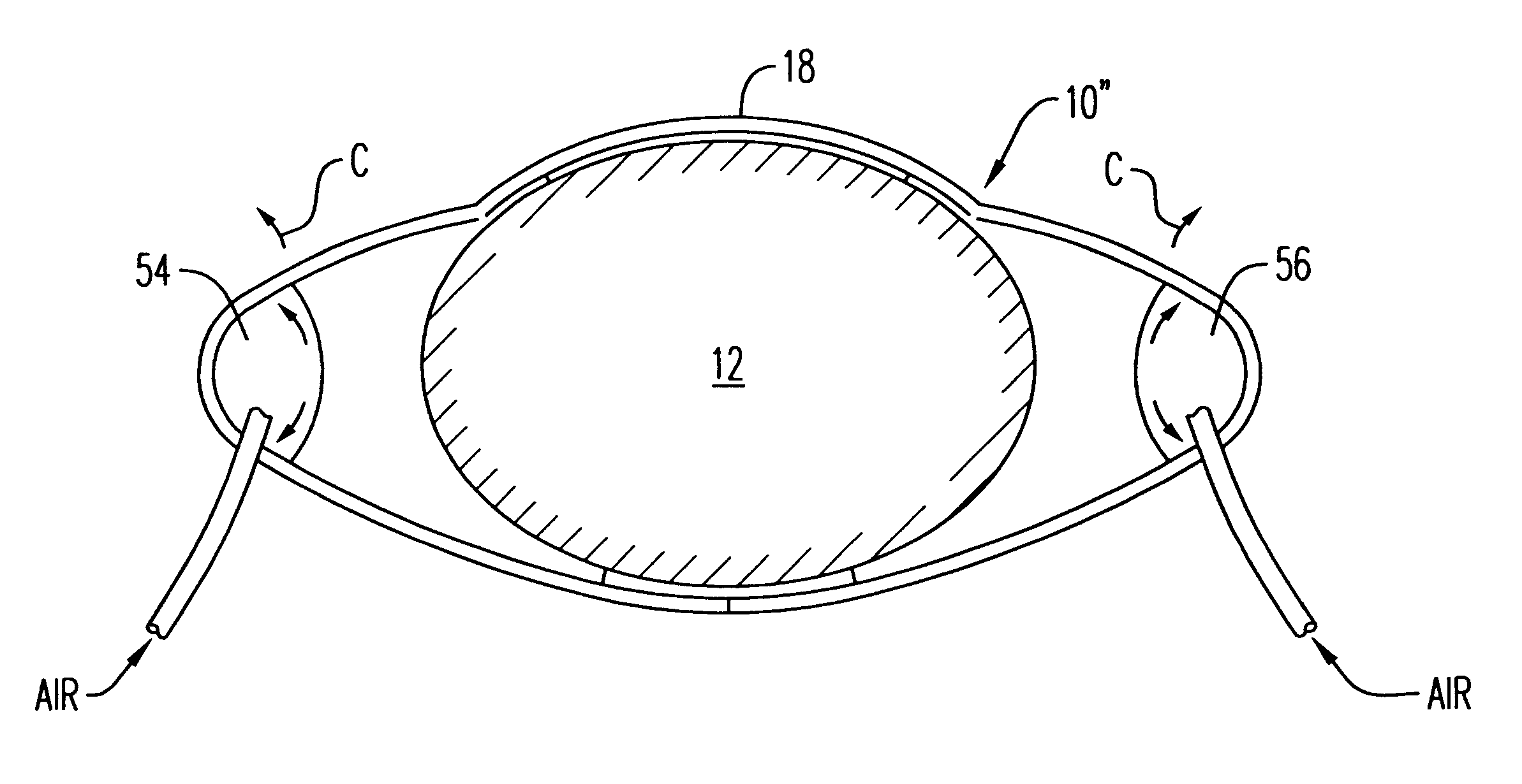 Chest brace and method of using same