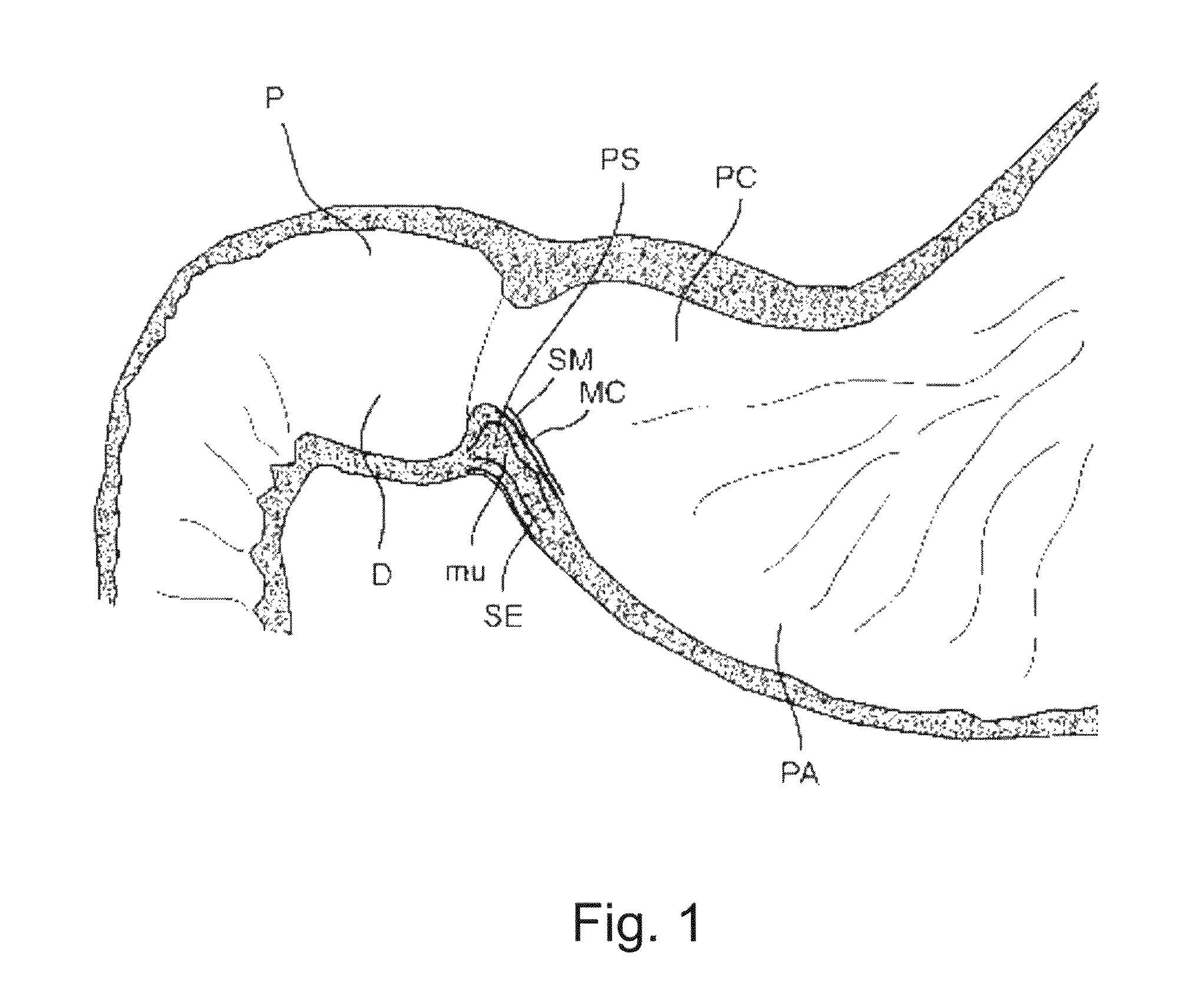 Devices and methods for altering eating behavior