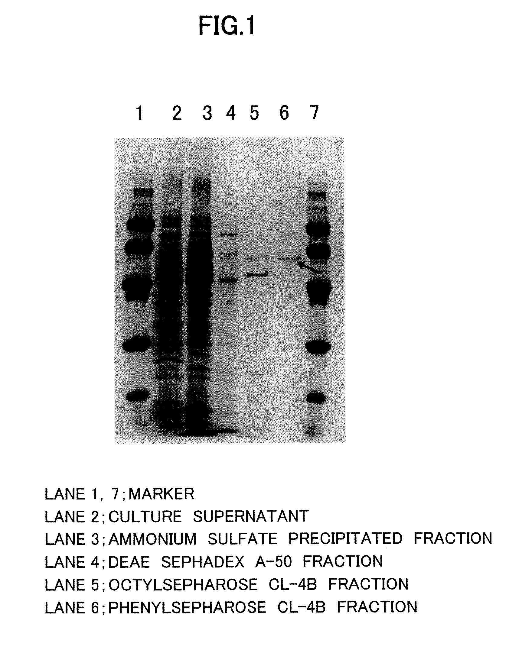 N-epsilon-acyl-l-lysine-specific aminoacylase