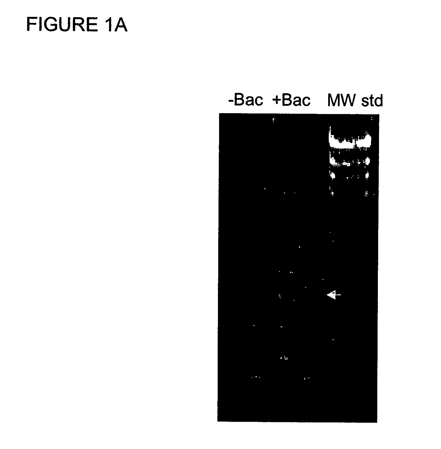 Methods and compounds for prevention and treatment of elevated intraocular pressure and related conditions