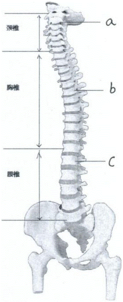 A human posture correction device based on kinect sensor