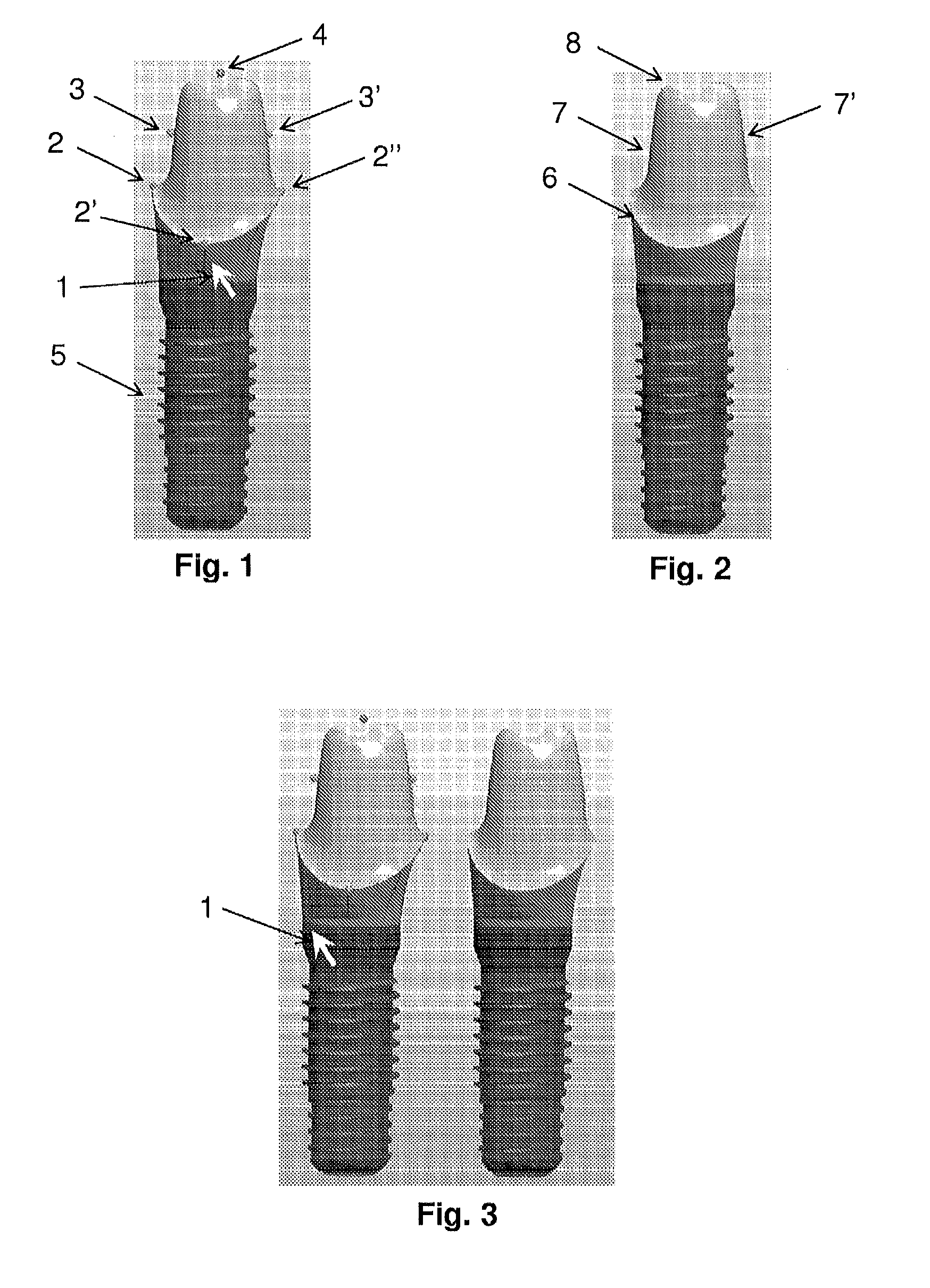 Tools for customized design of dental restorations