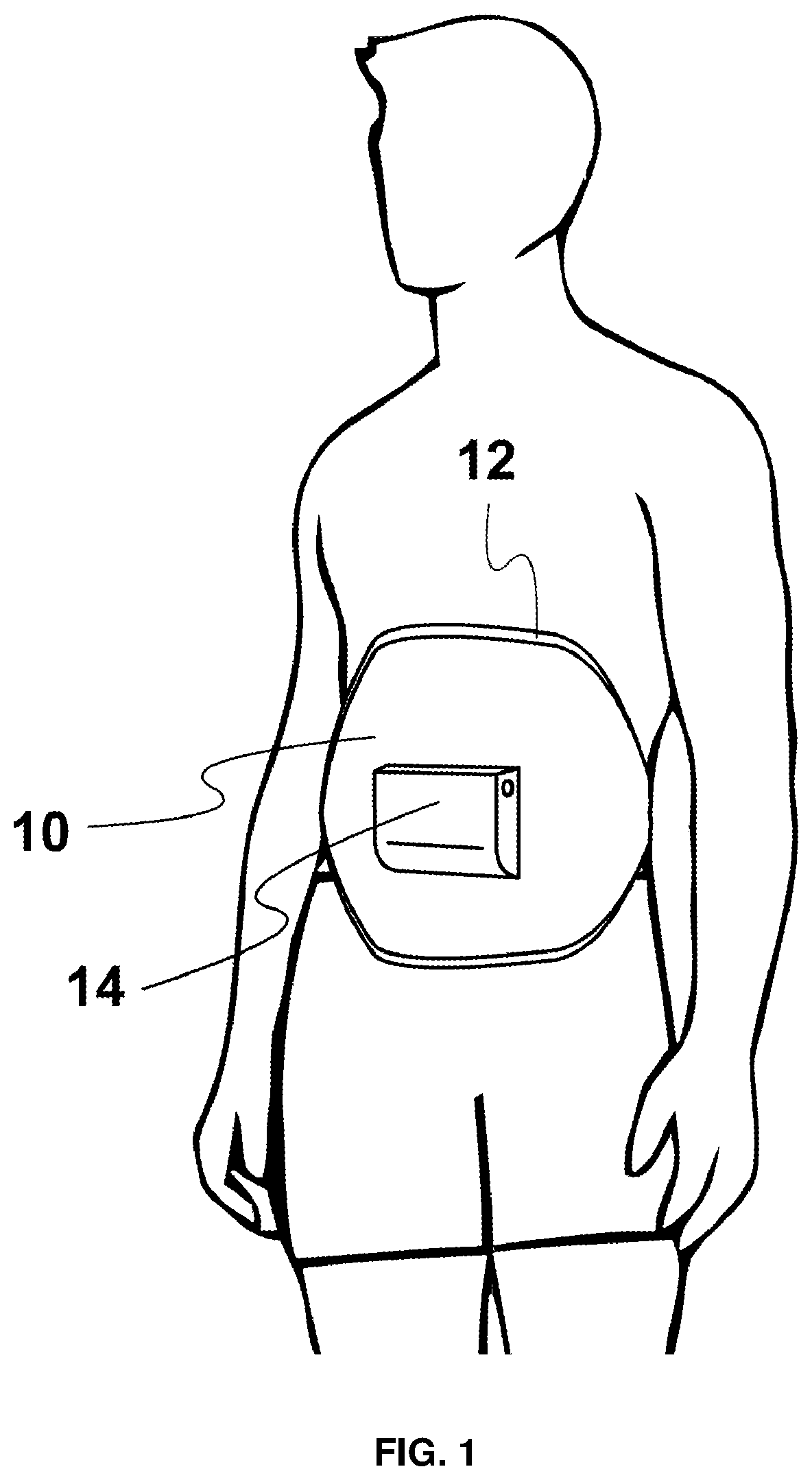 Innovations in mechanical ventilators