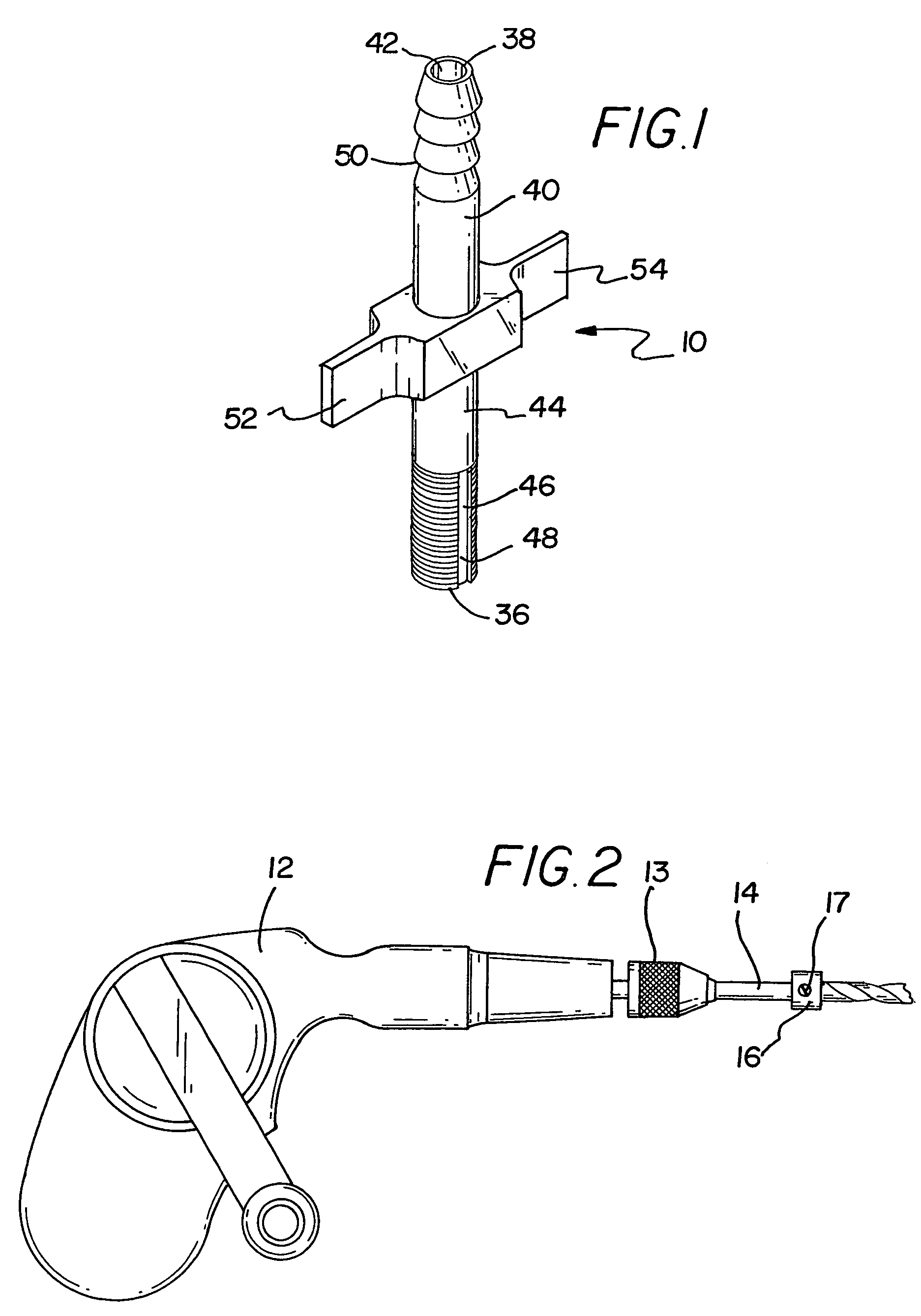 Subdural evacuating port system