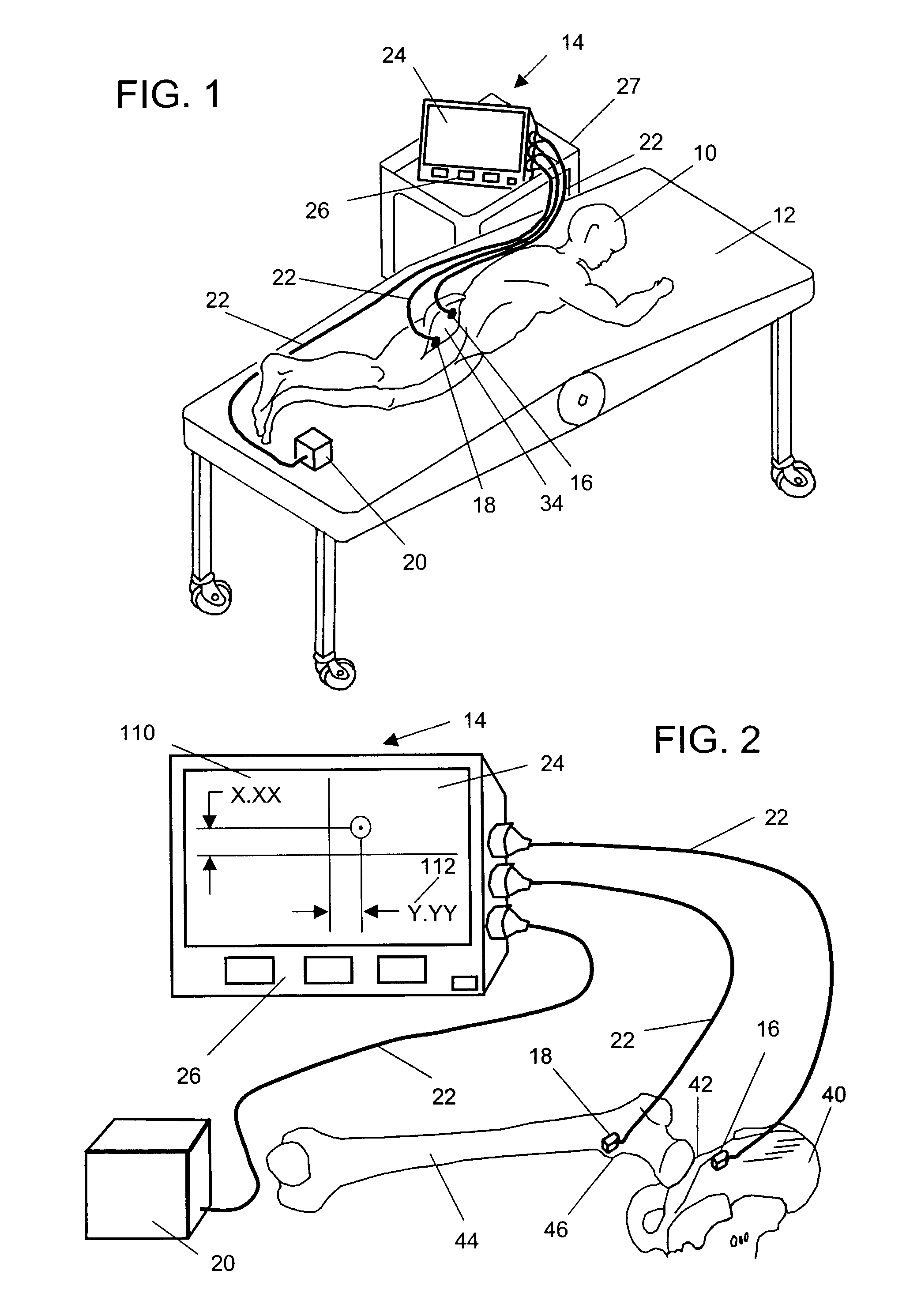 Apparatus and methods for making intraoperative orthopedic measurements