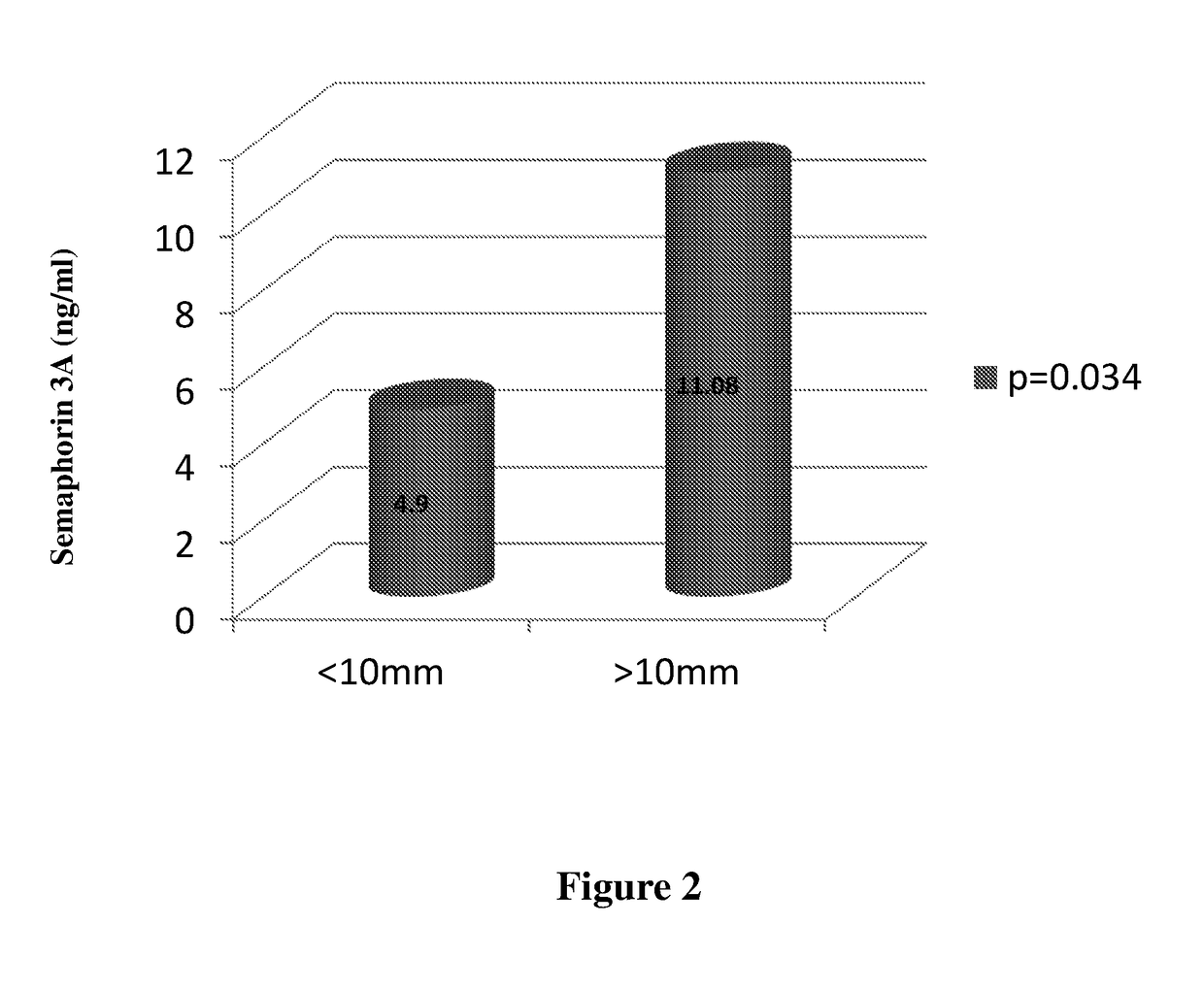 Semaphorin 3A as a diagnostic marker for urothelial cancer