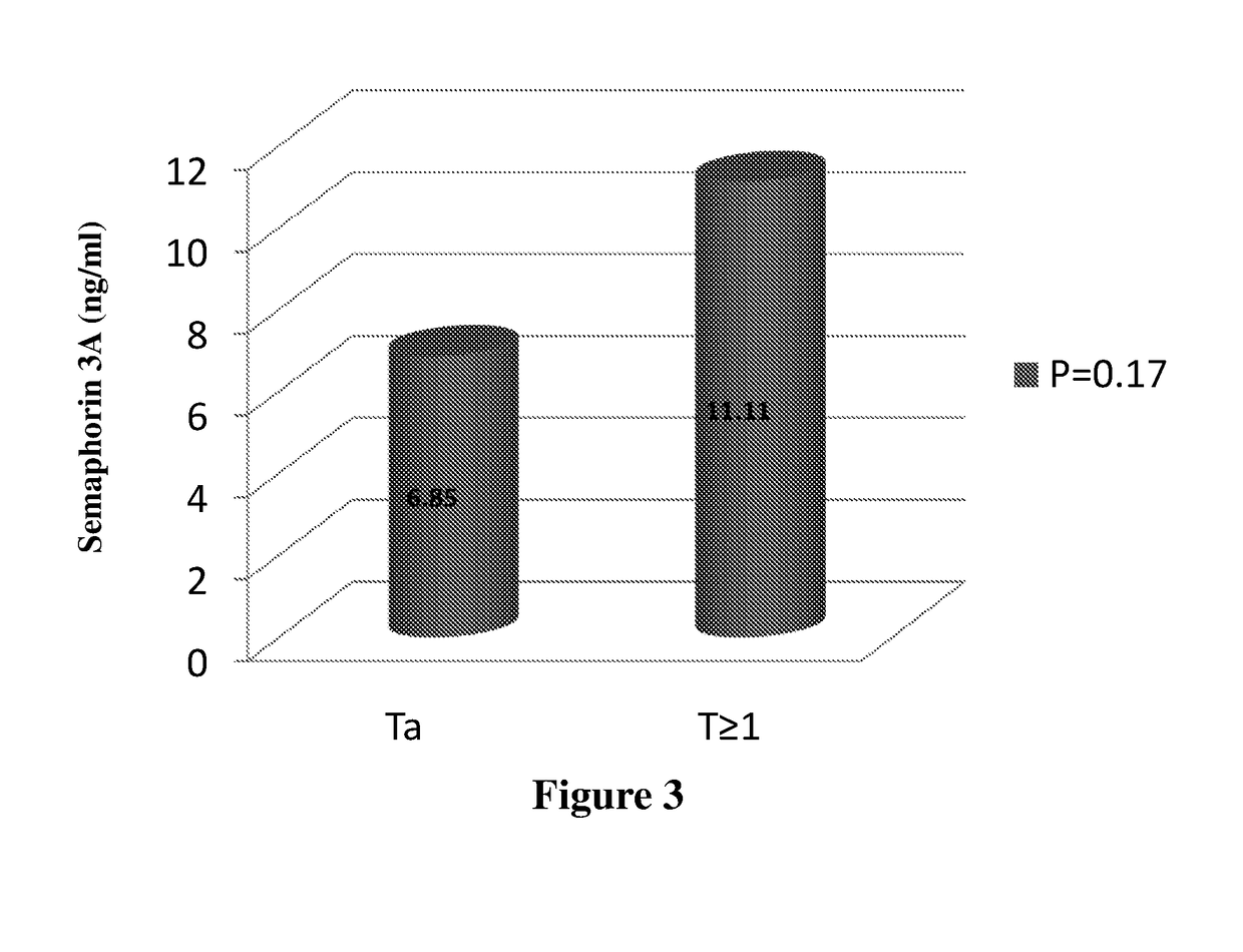 Semaphorin 3A as a diagnostic marker for urothelial cancer