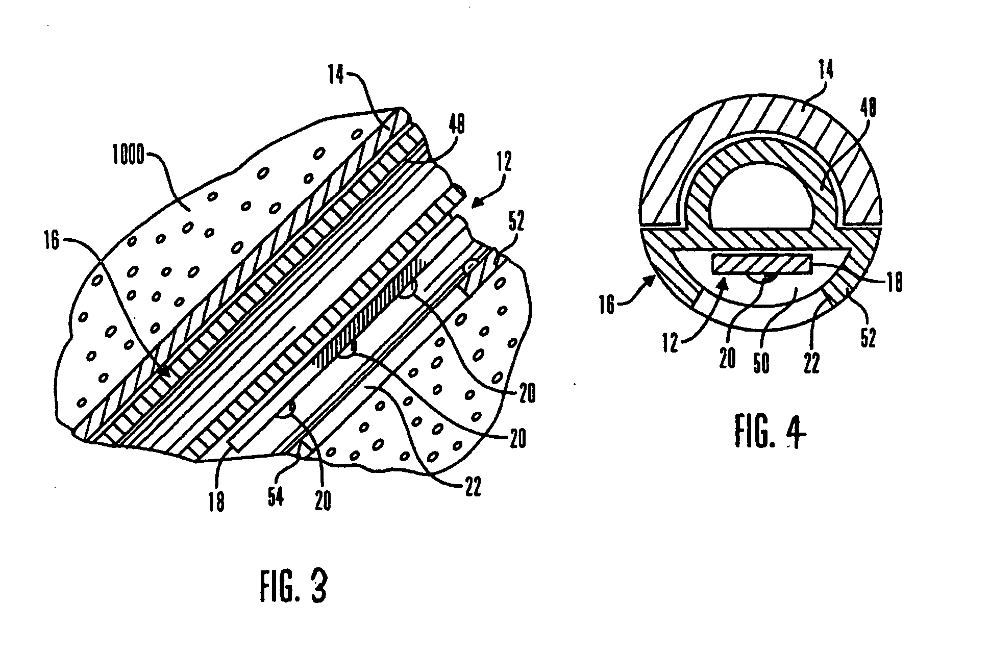 Real-time self-calibrating sensor system and method