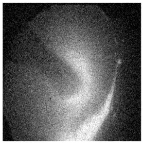 A Nonlocal Mean Denoising Optimization Method Based on Structural Similarity