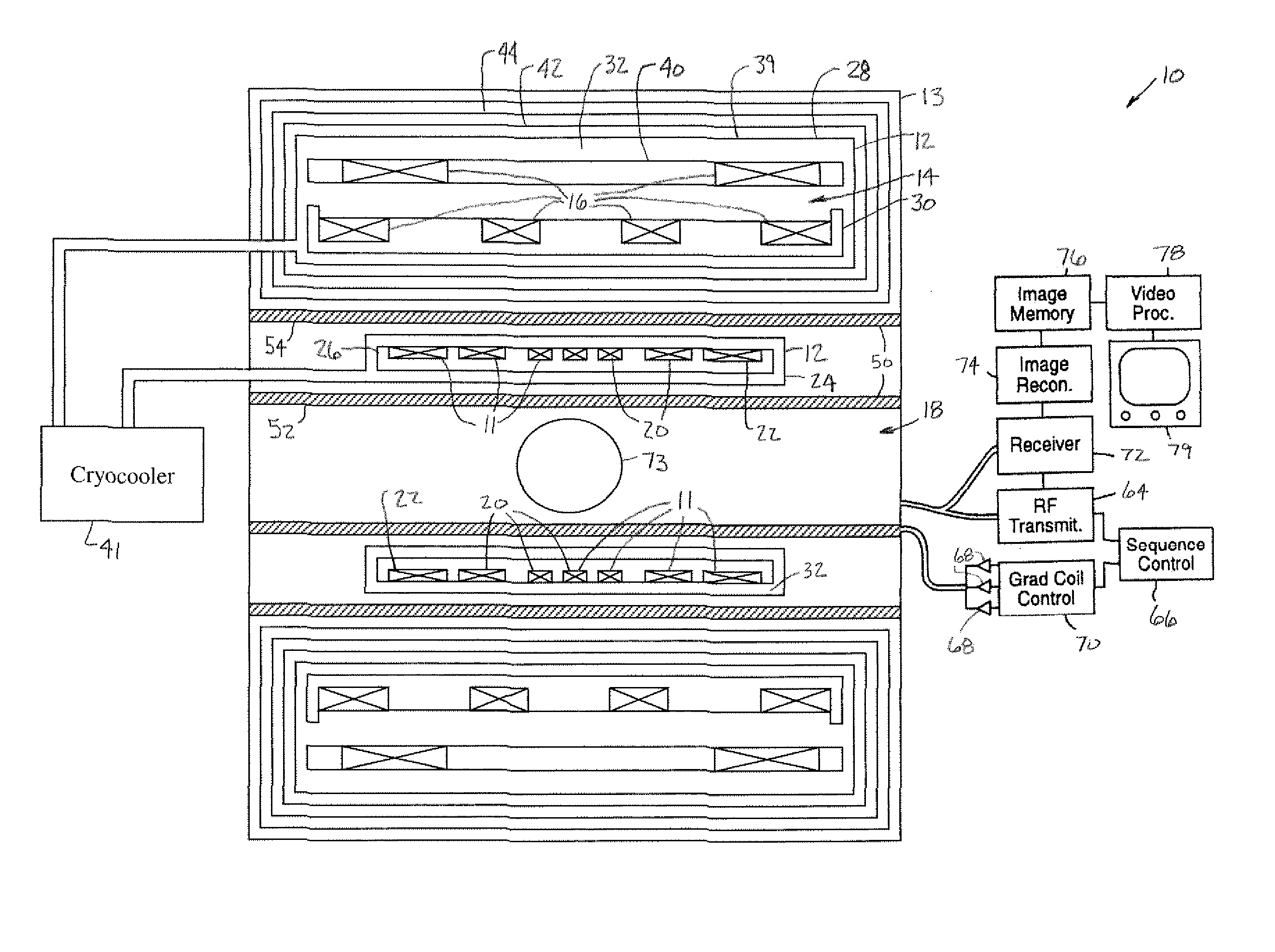 MRI System Utilizing Supplemental Static Field-Shaping Coils