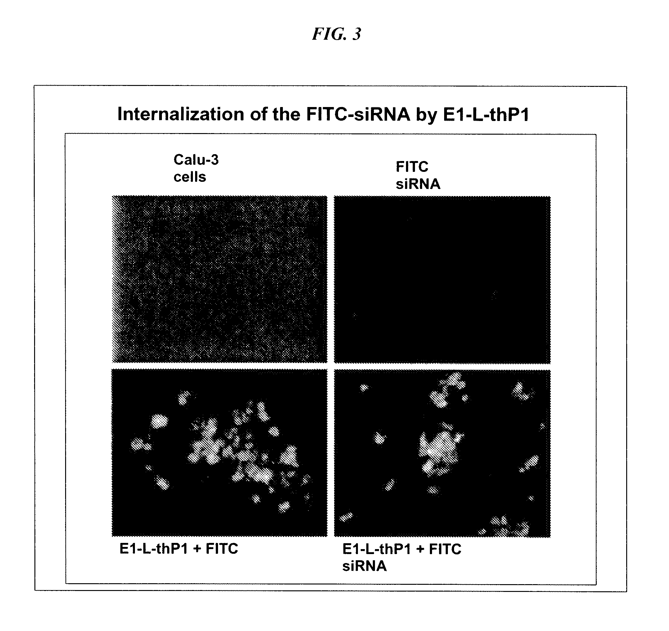 Dock-and-lock (DNL) complexes for delivery of interference RNA