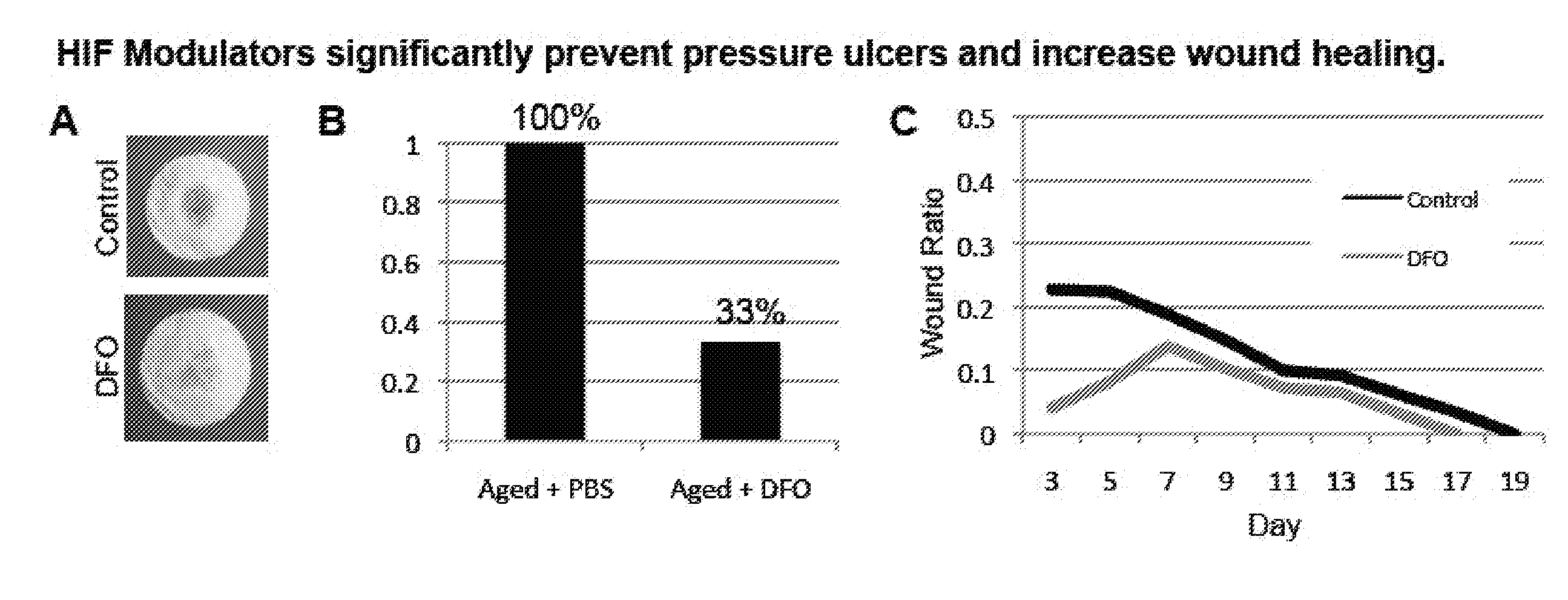 Topical and Transdermal Delivery of HIF-1 Modulators to Prevent and Treat Chronic Wounds