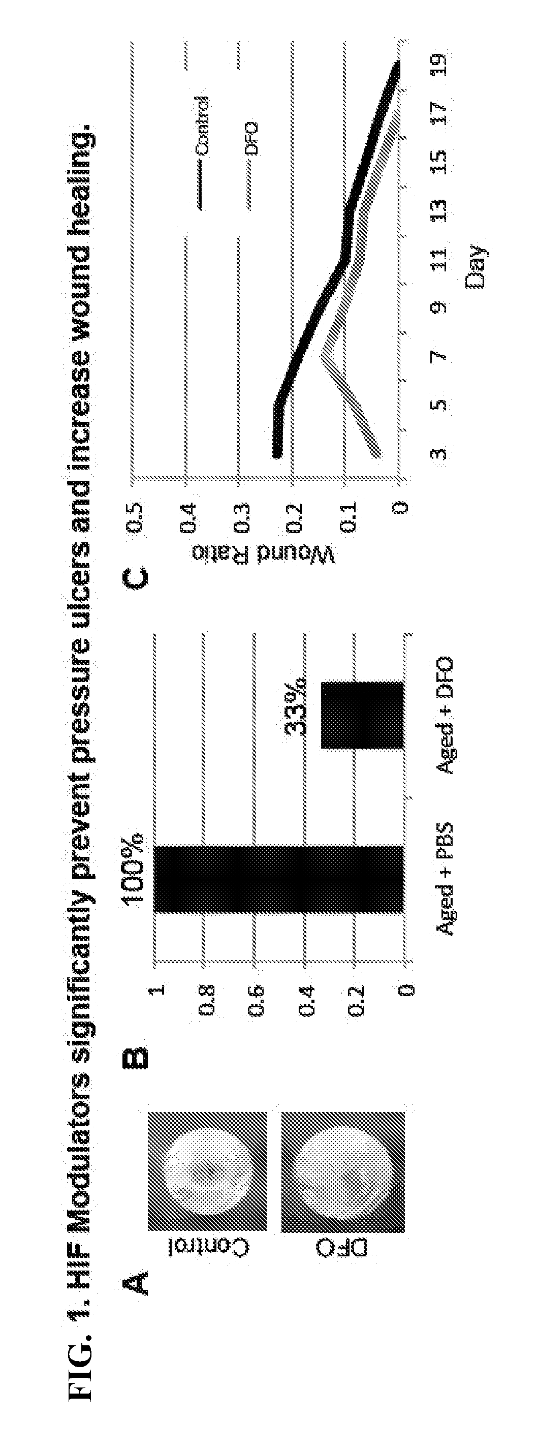 Topical and Transdermal Delivery of HIF-1 Modulators to Prevent and Treat Chronic Wounds