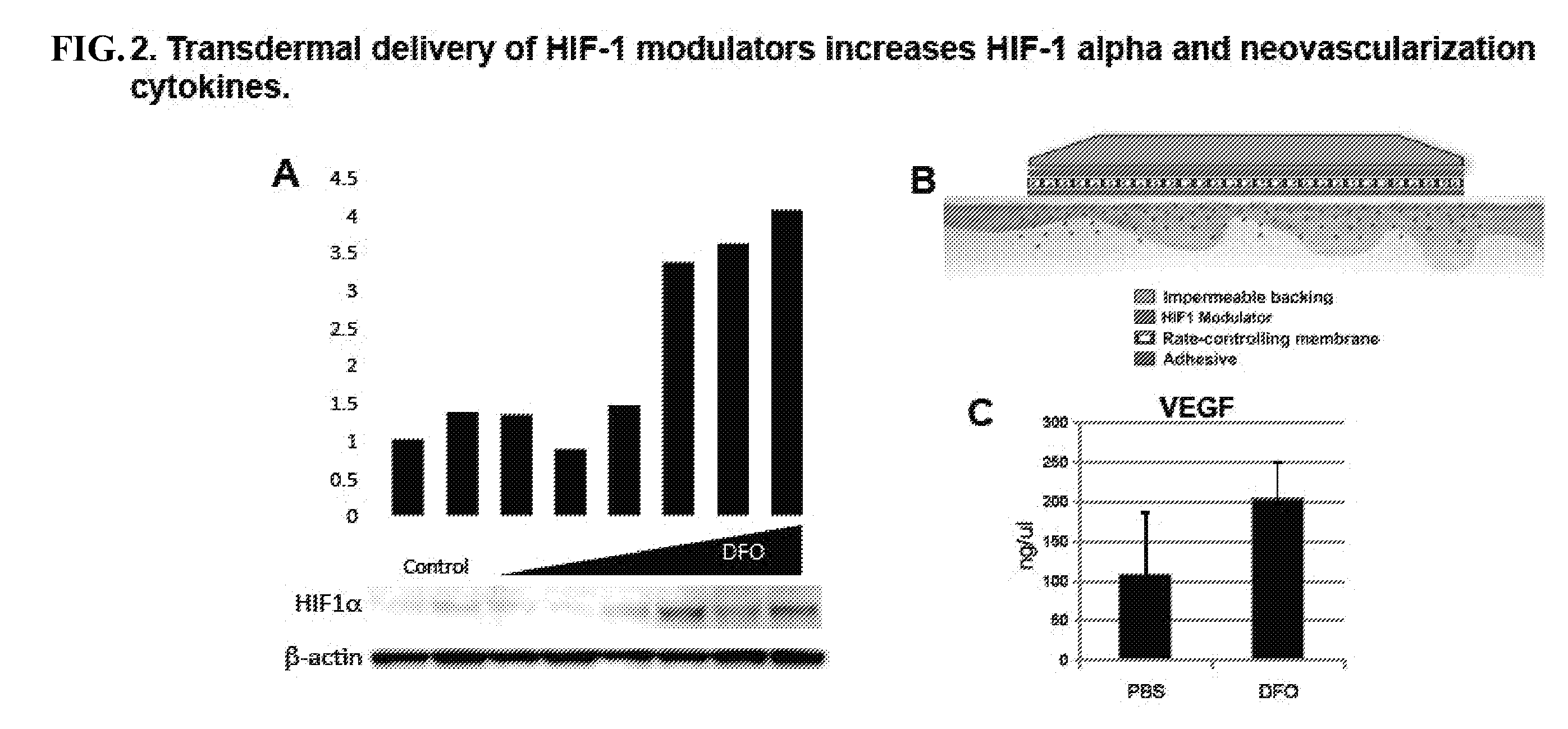 Topical and Transdermal Delivery of HIF-1 Modulators to Prevent and Treat Chronic Wounds