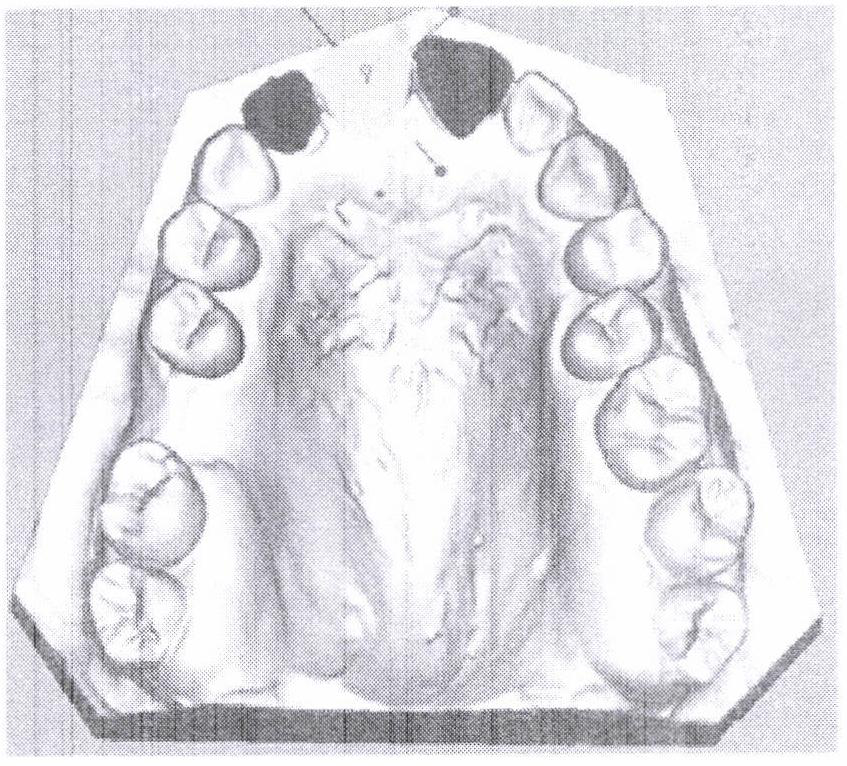 A Simulation Method of Gingival Deformation Based on the Mass Spring Model of Tooth Long Axis