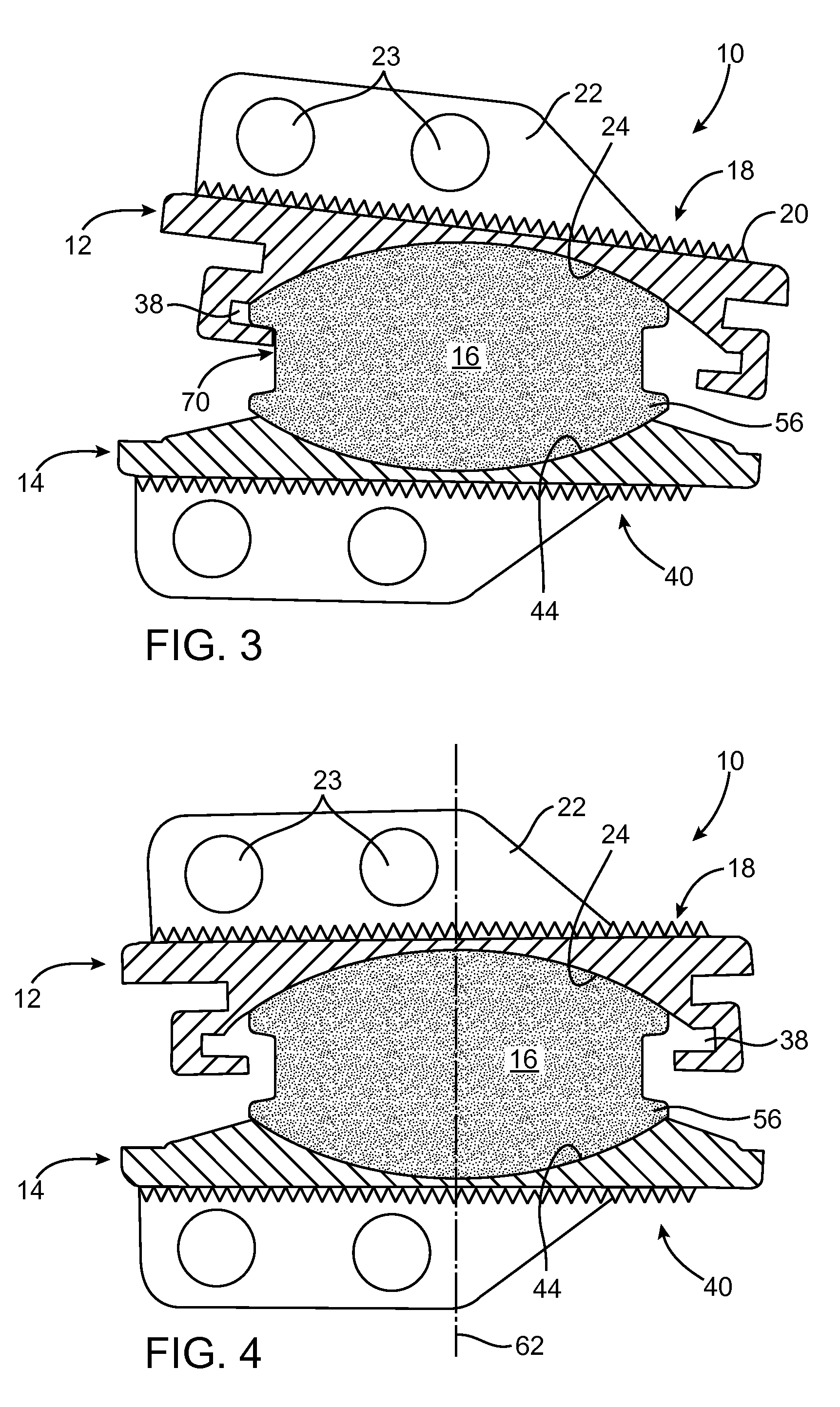 Prosthetic Disc for Intervertebral Insertion