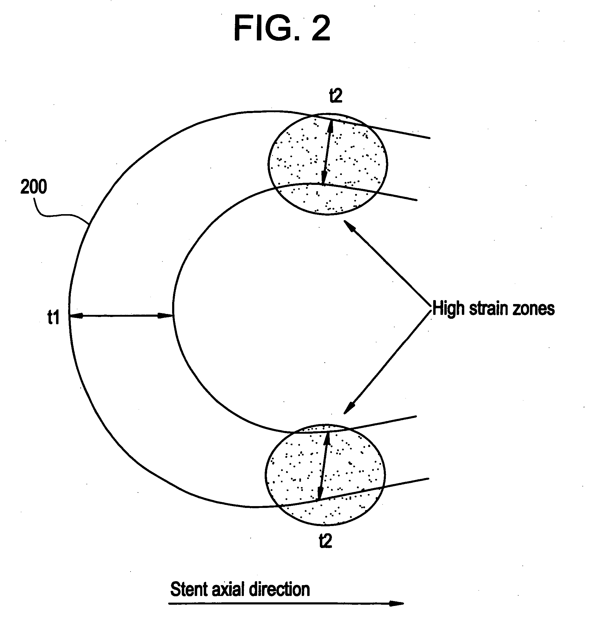 Polymeric stent having modified molecular structures in the flexible connectors and in the radial struts and the radial arcs of the hoops