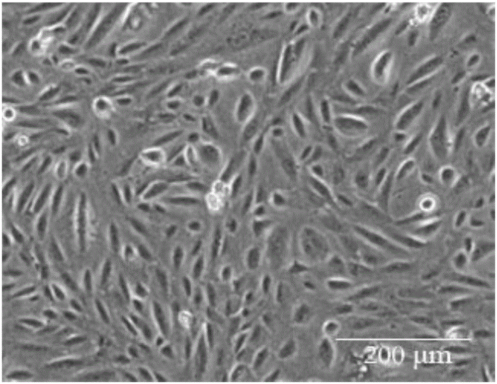 Double-layer tissue engineering skin and preparation method thereof