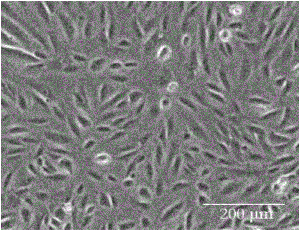 Double-layer tissue engineering skin and preparation method thereof