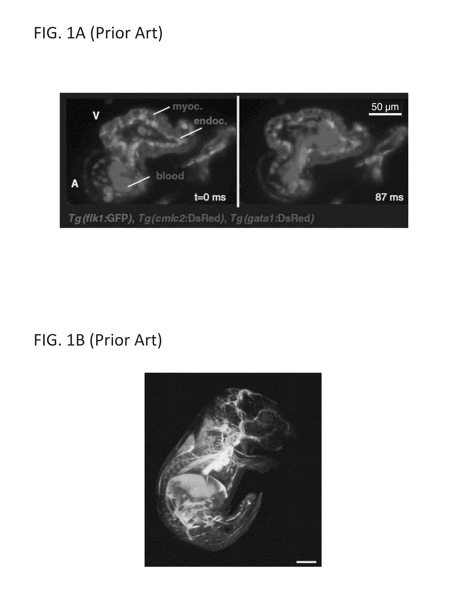 Multiple-photon excitation light sheet illumination microscope