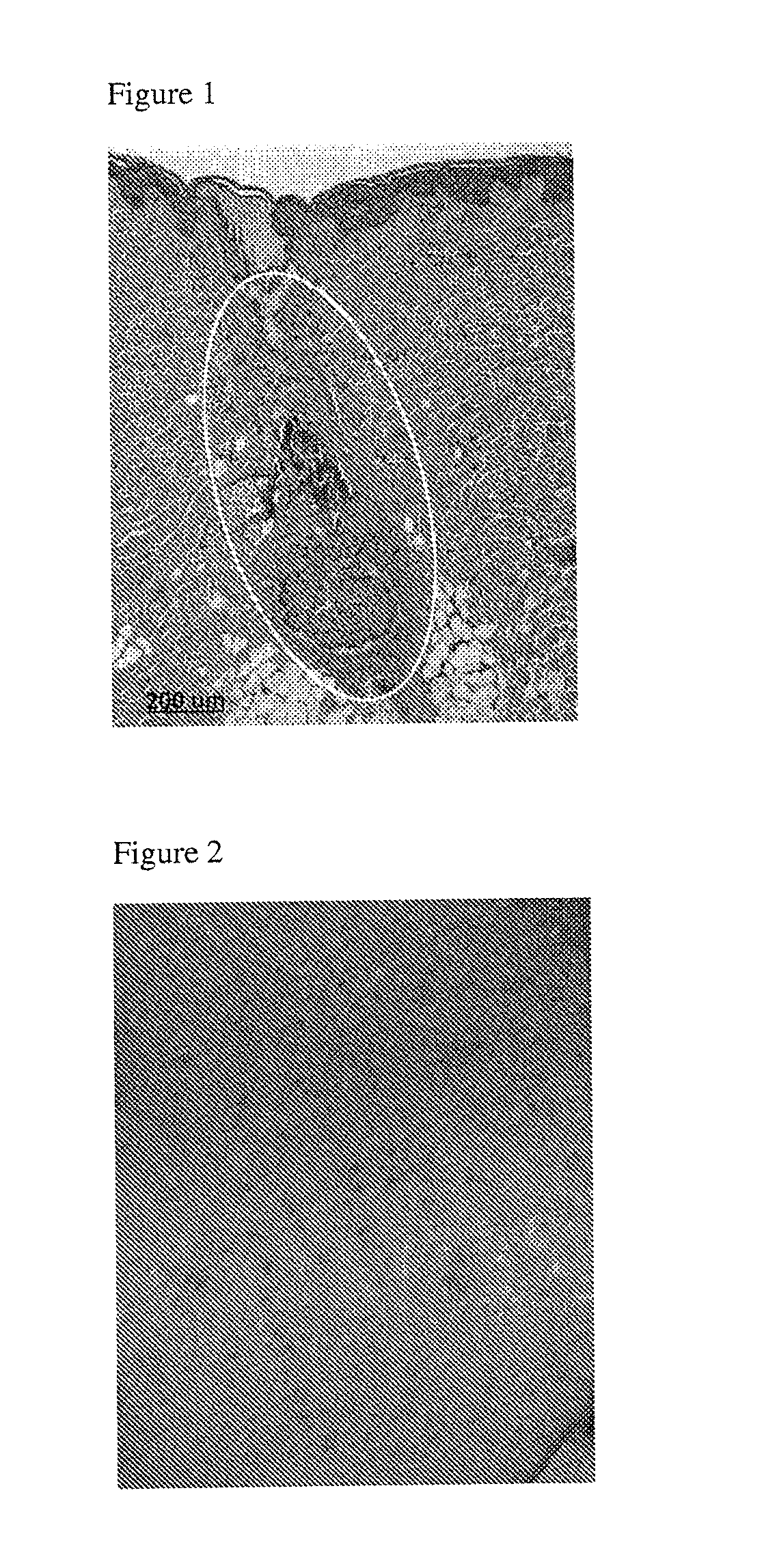 Treatment intervals for use of compositions comprising energy absorbing materials for dermatological applications