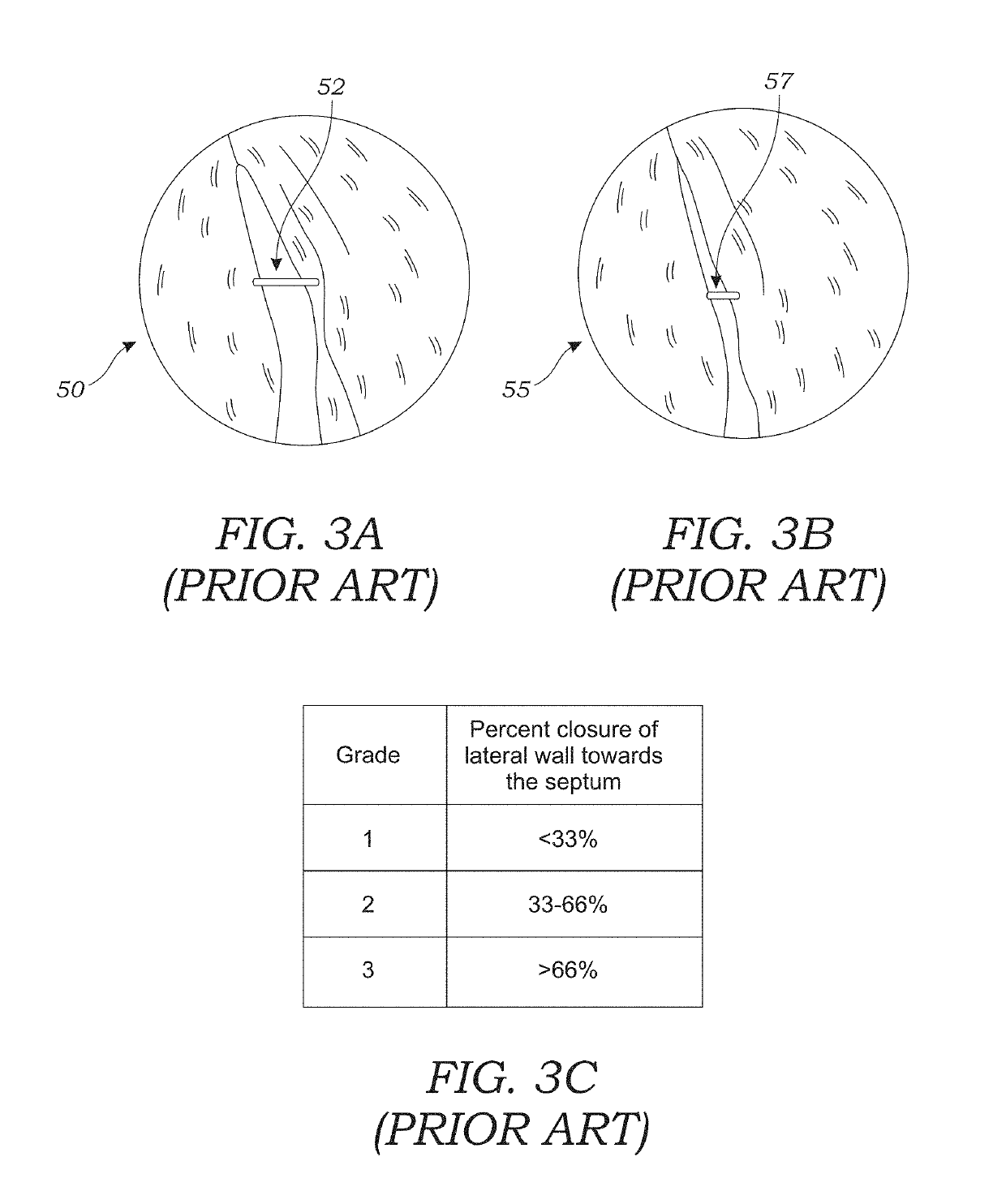 Diagnostic tool and method of use